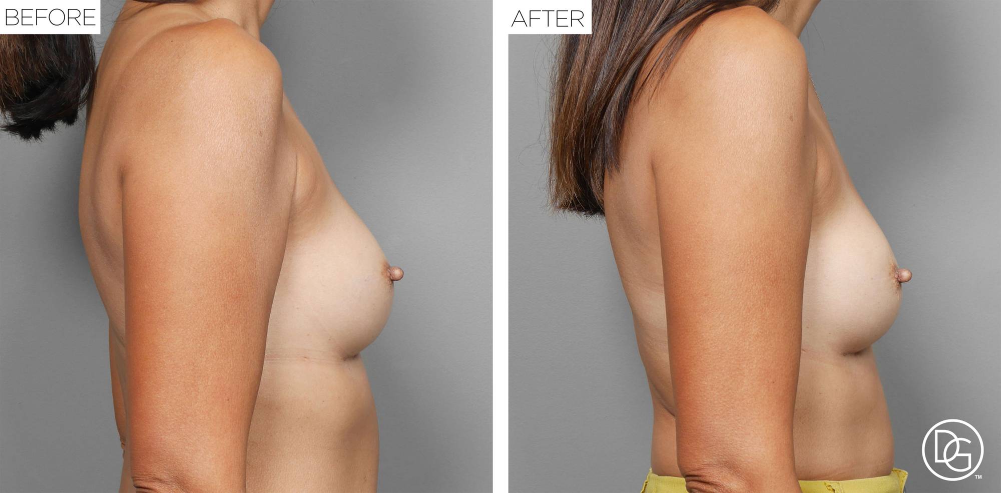 Before & After Image