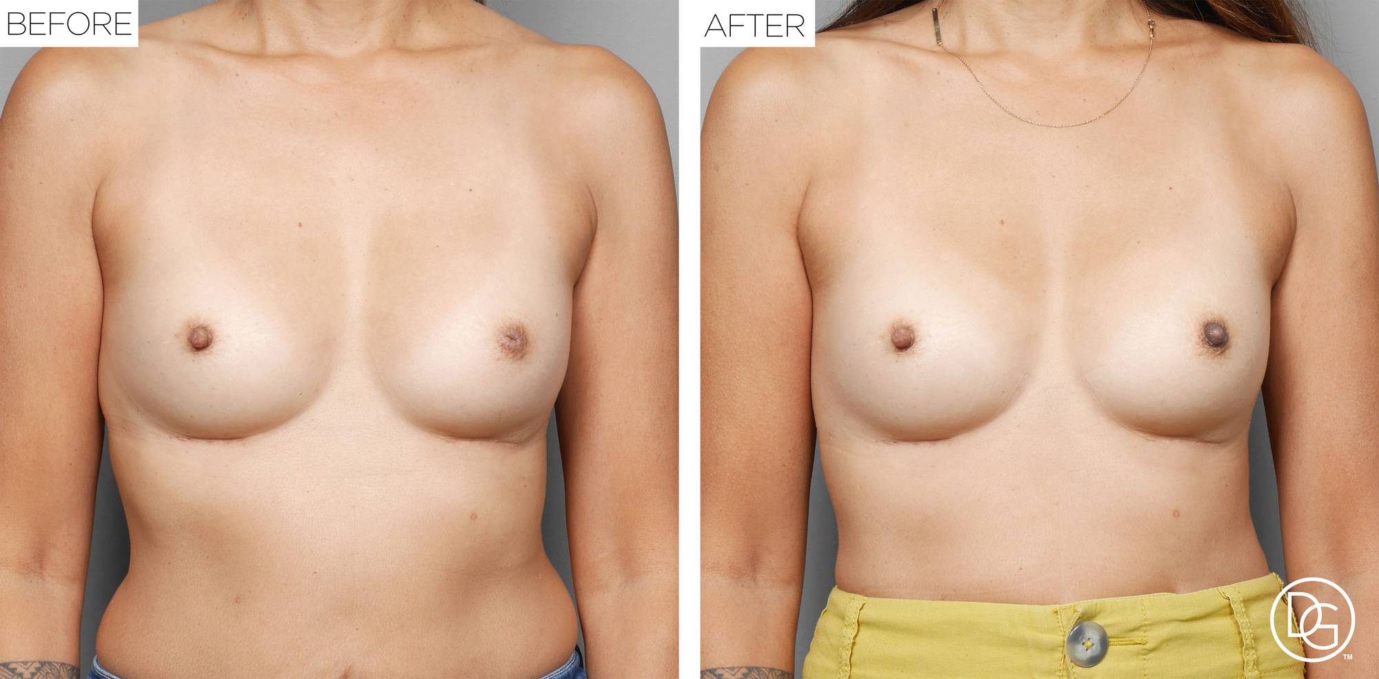 Before & After Image