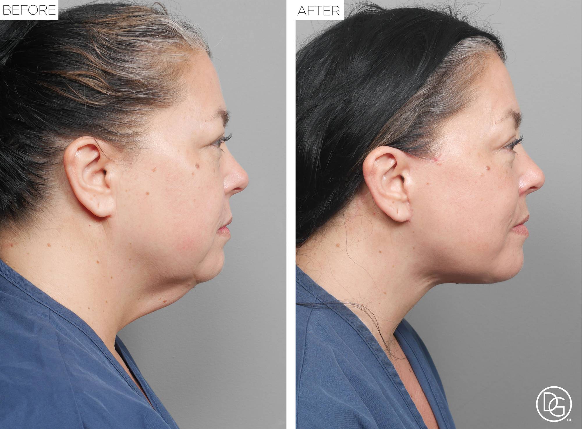 Before & After Image