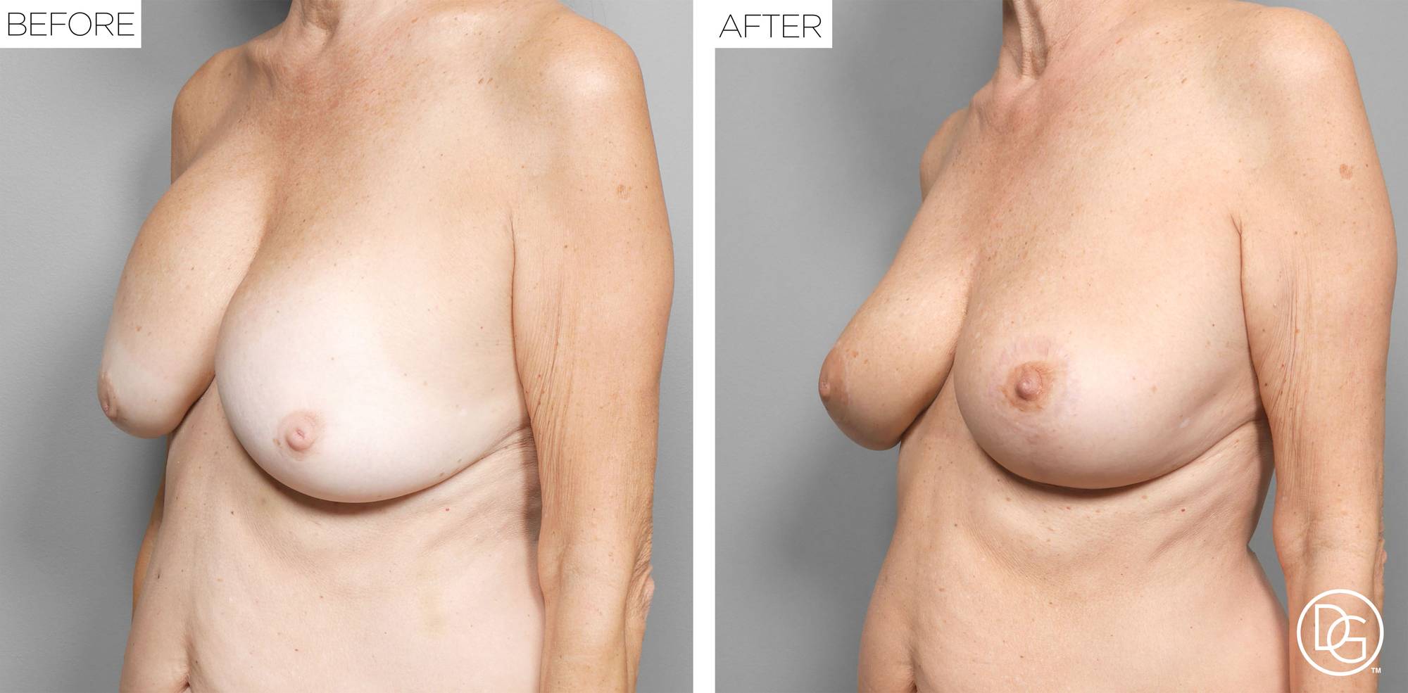 Before & After Image