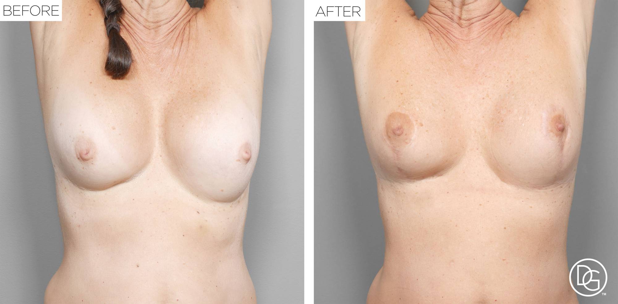 Before & After Image