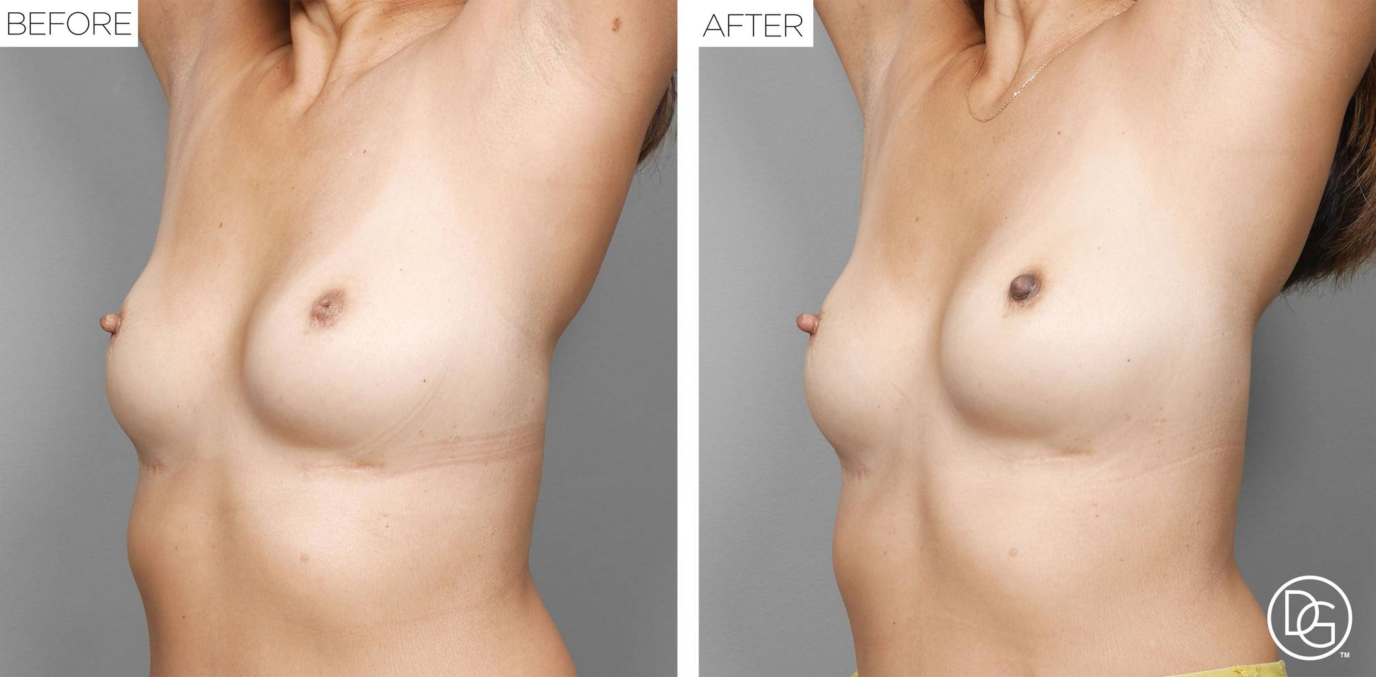 Before & After Image