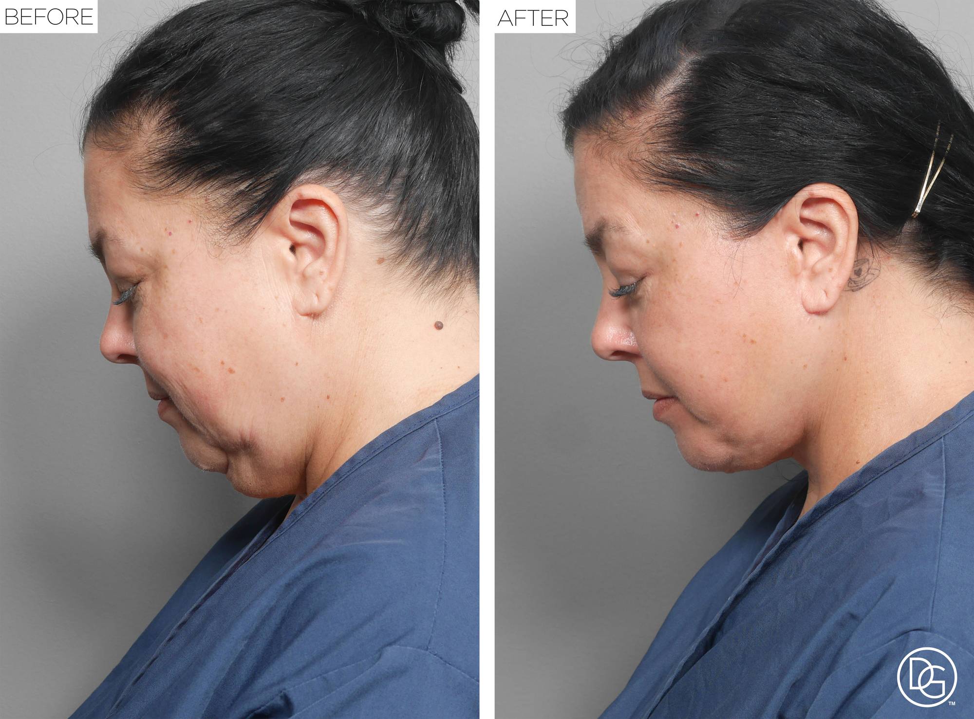 Before & After Image