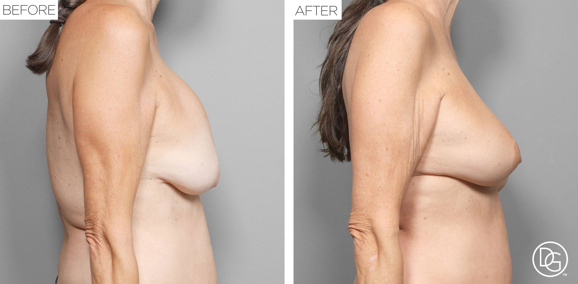 Before & After Image