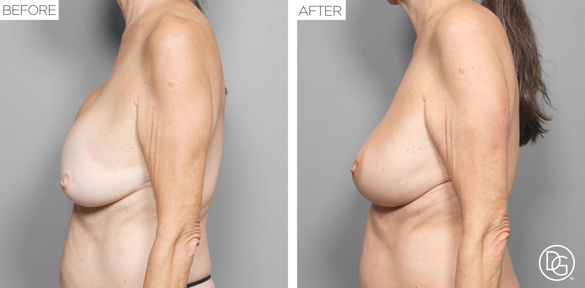 Before & After Image