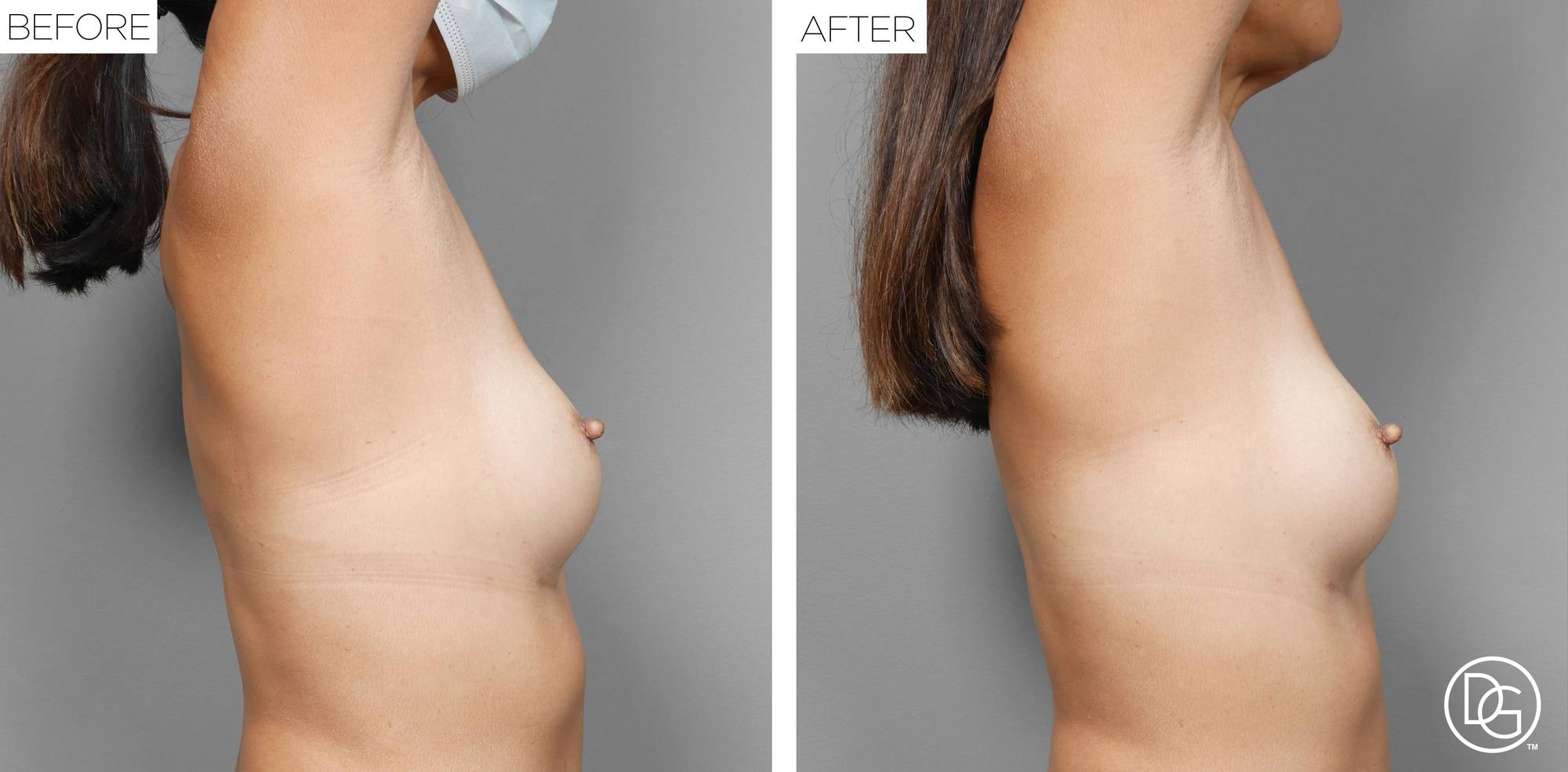 Before & After Image