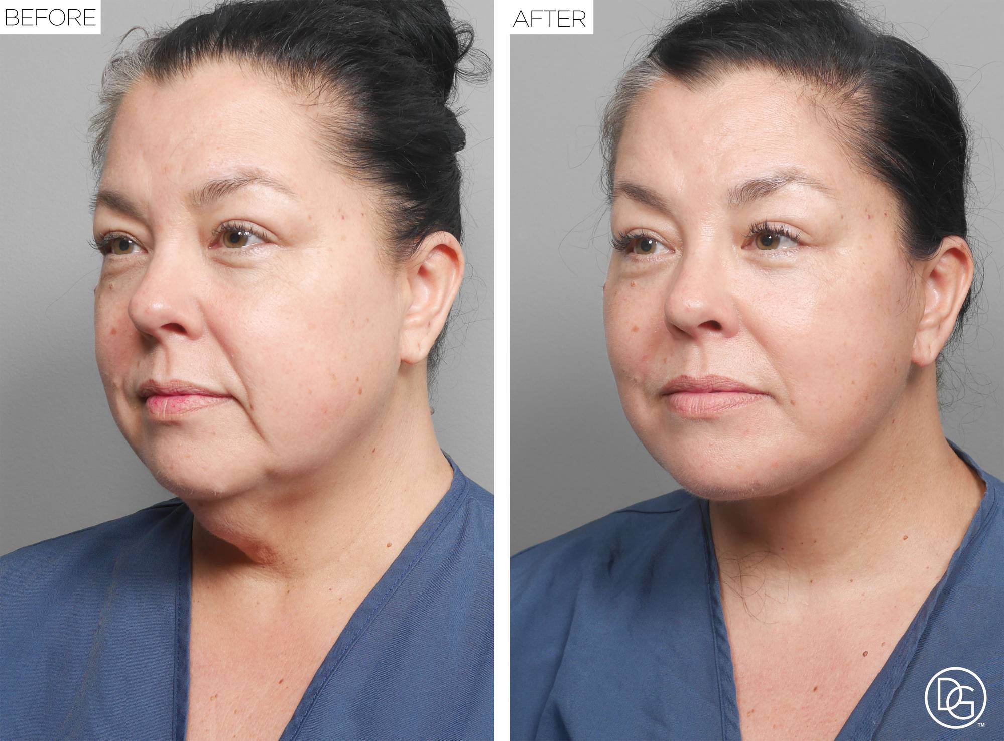 Before & After Image