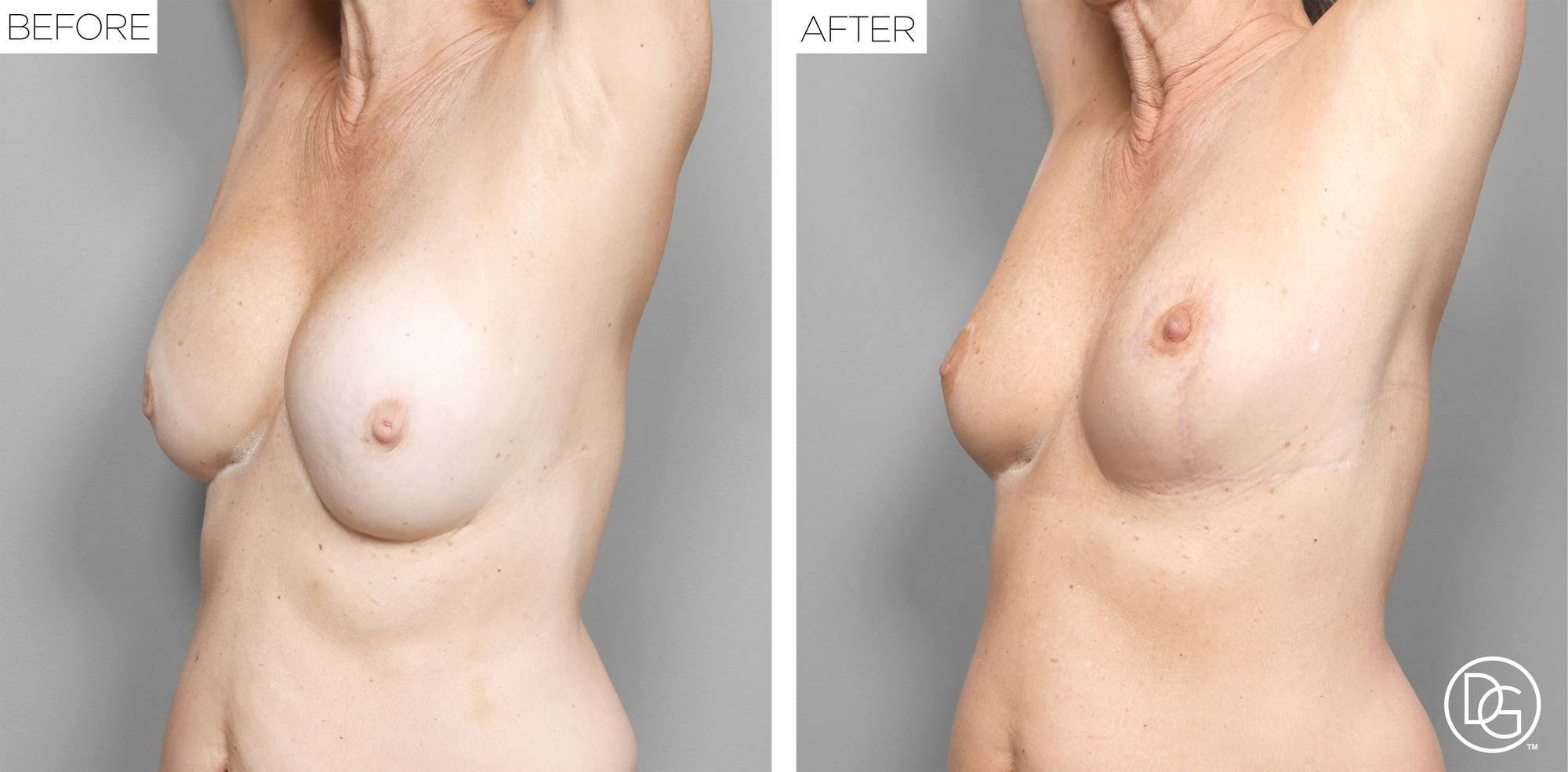 Before & After Image