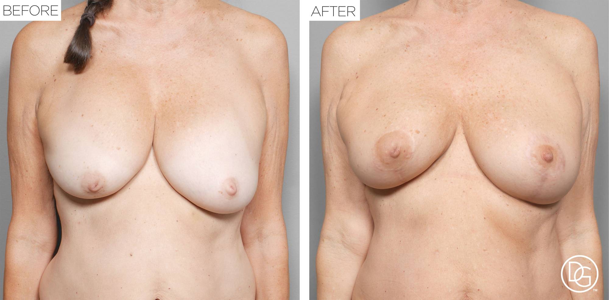 Before & After Image