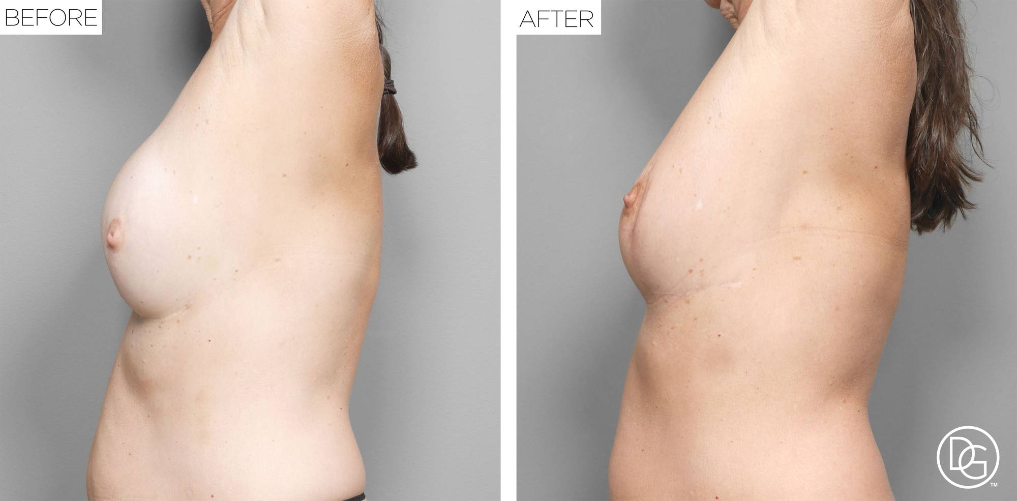 Before & After Image