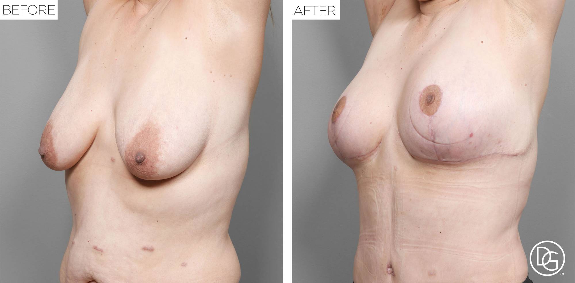 Before & After Image