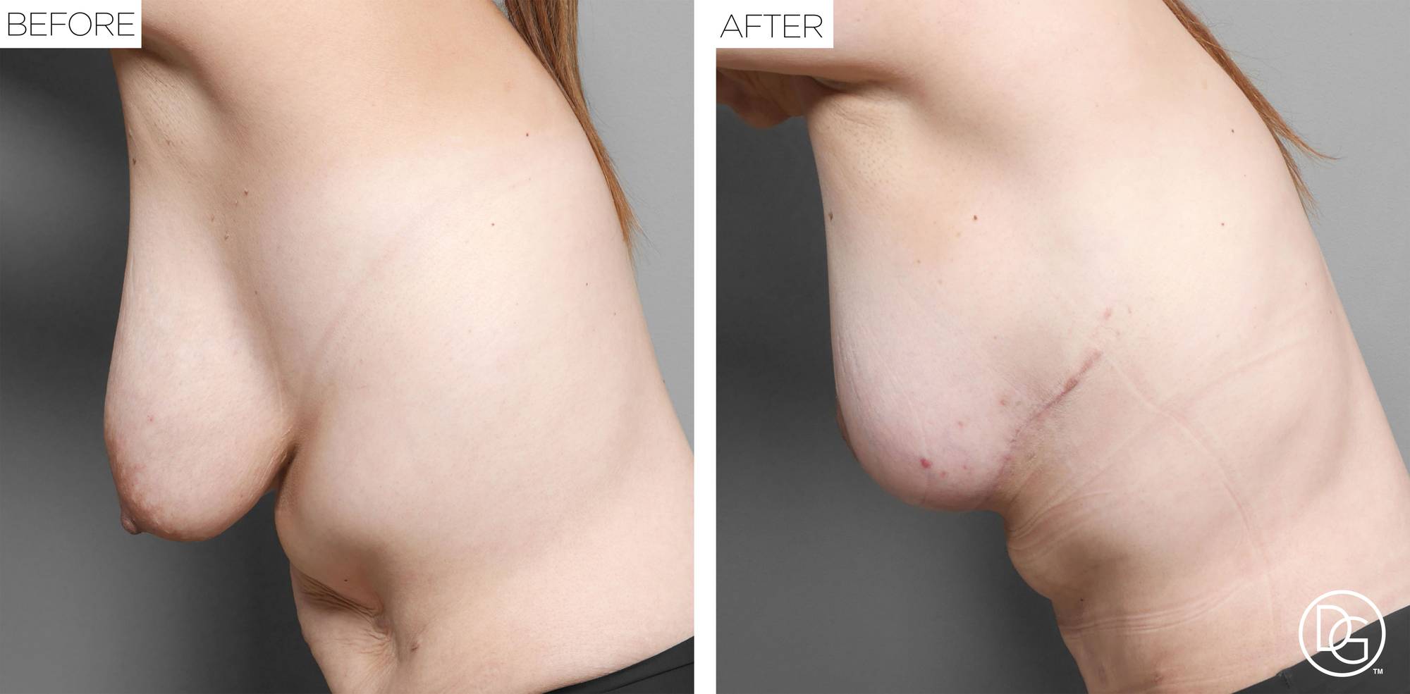 Before & After Image