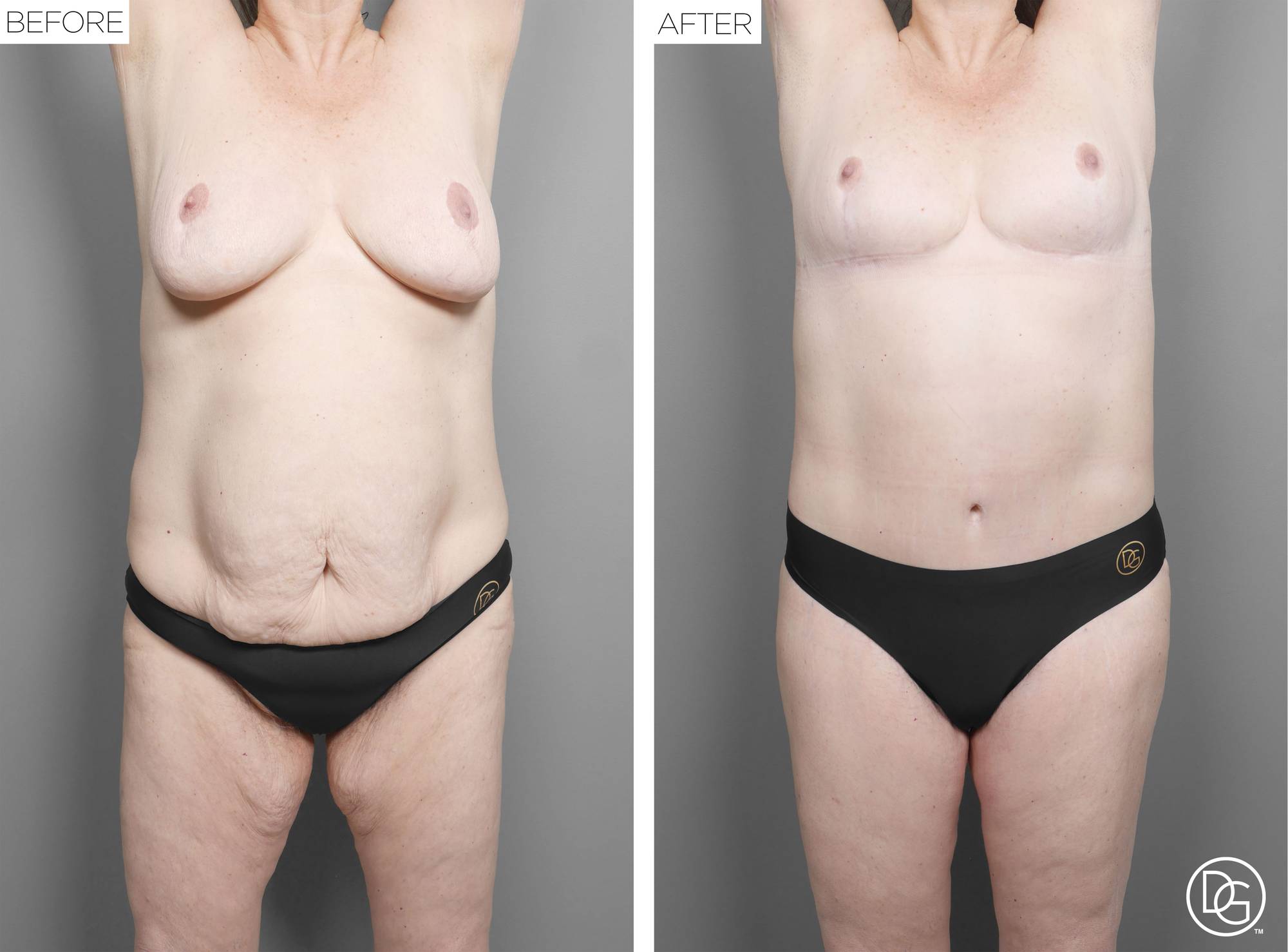 Before & After Image