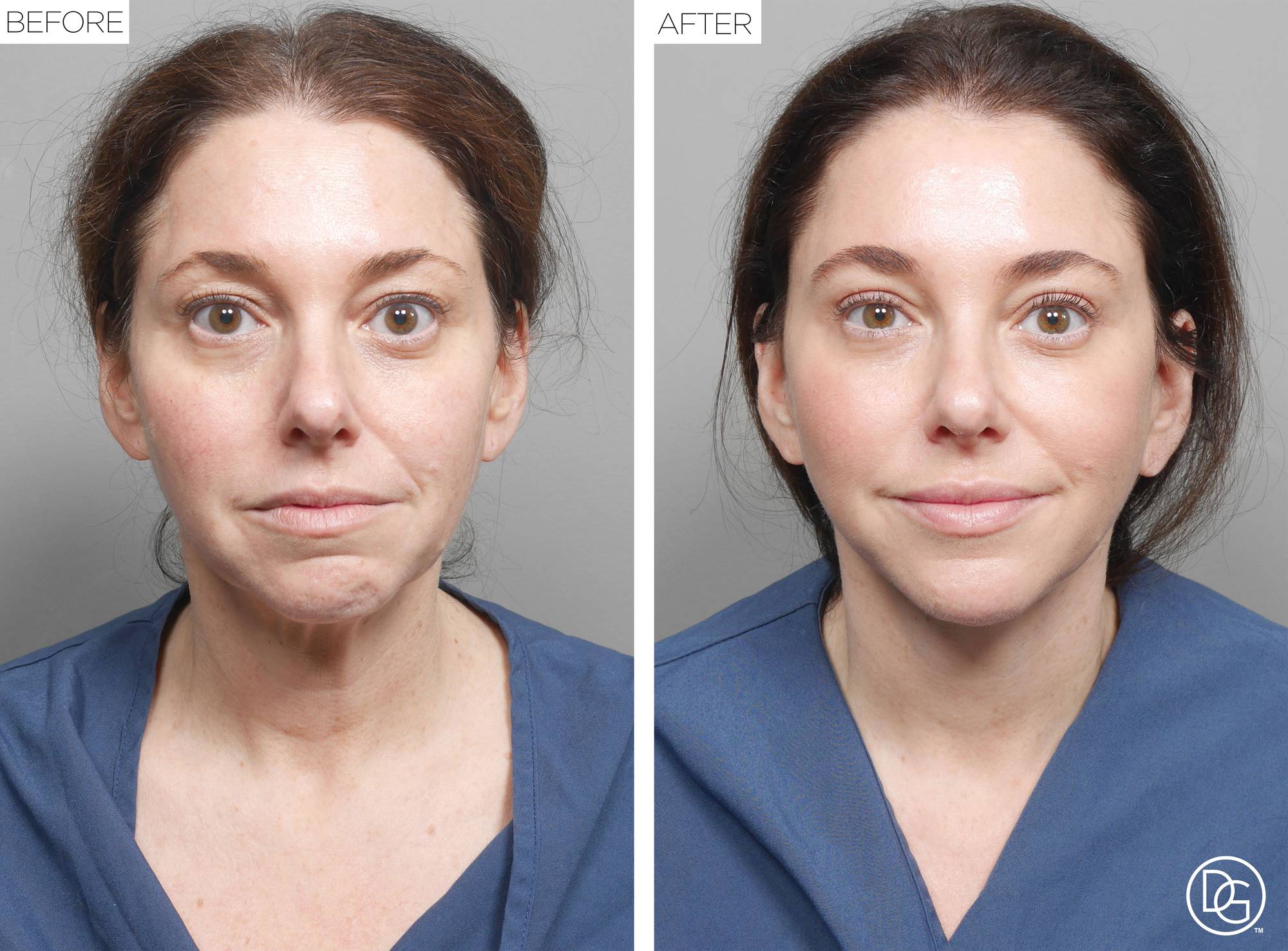 Before & After Image