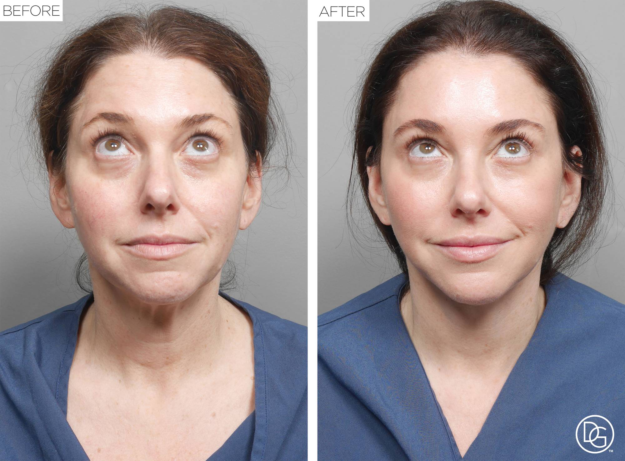 Before & After Image