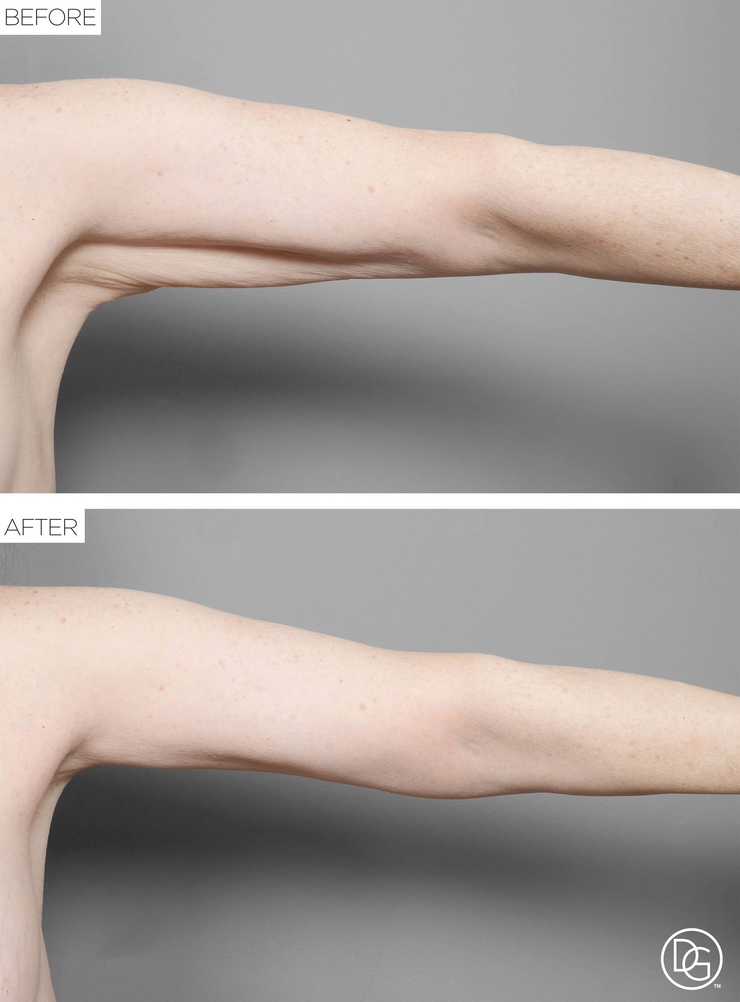 Before & After Image