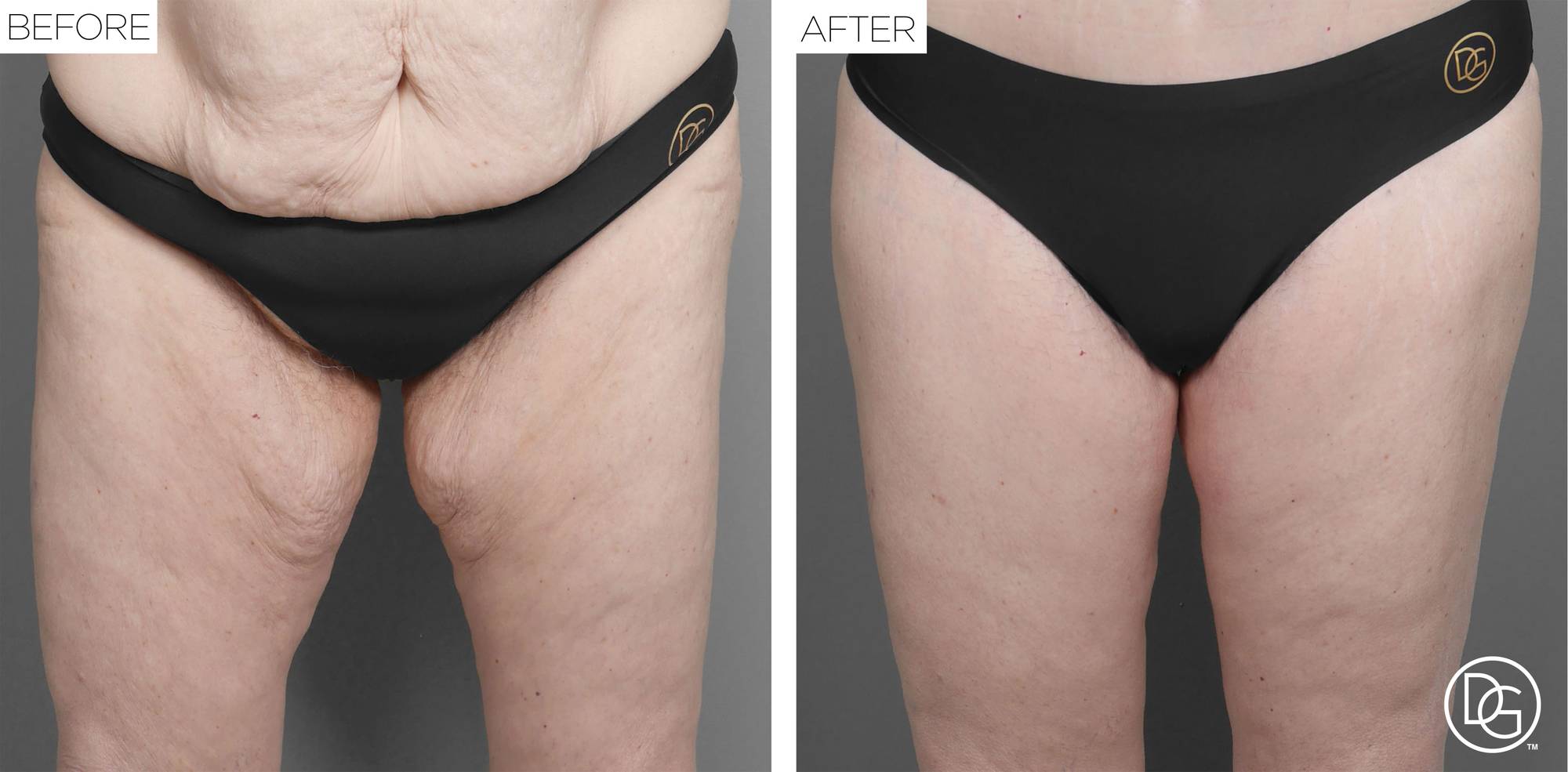 Before & After Image