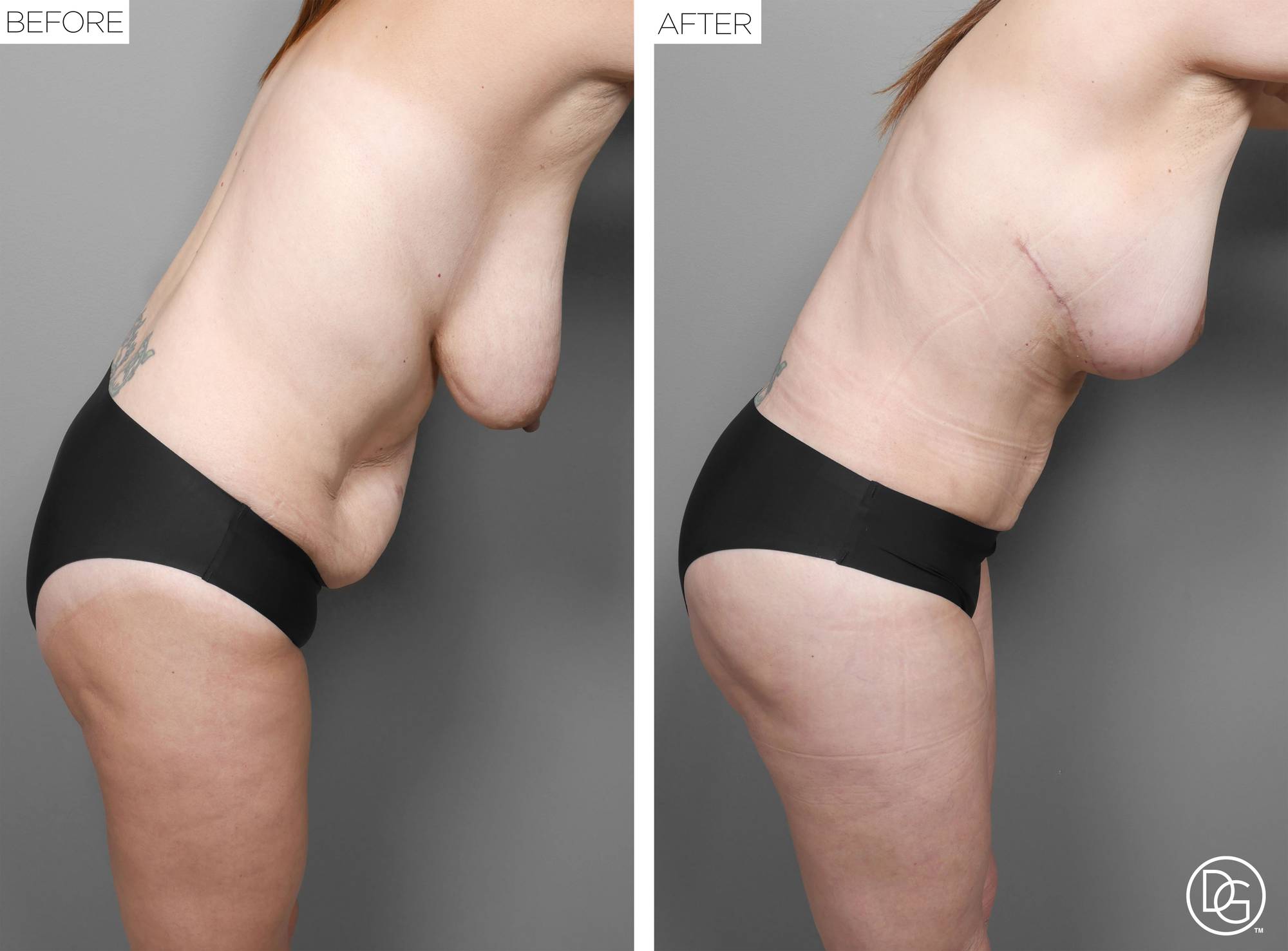 Before & After Image