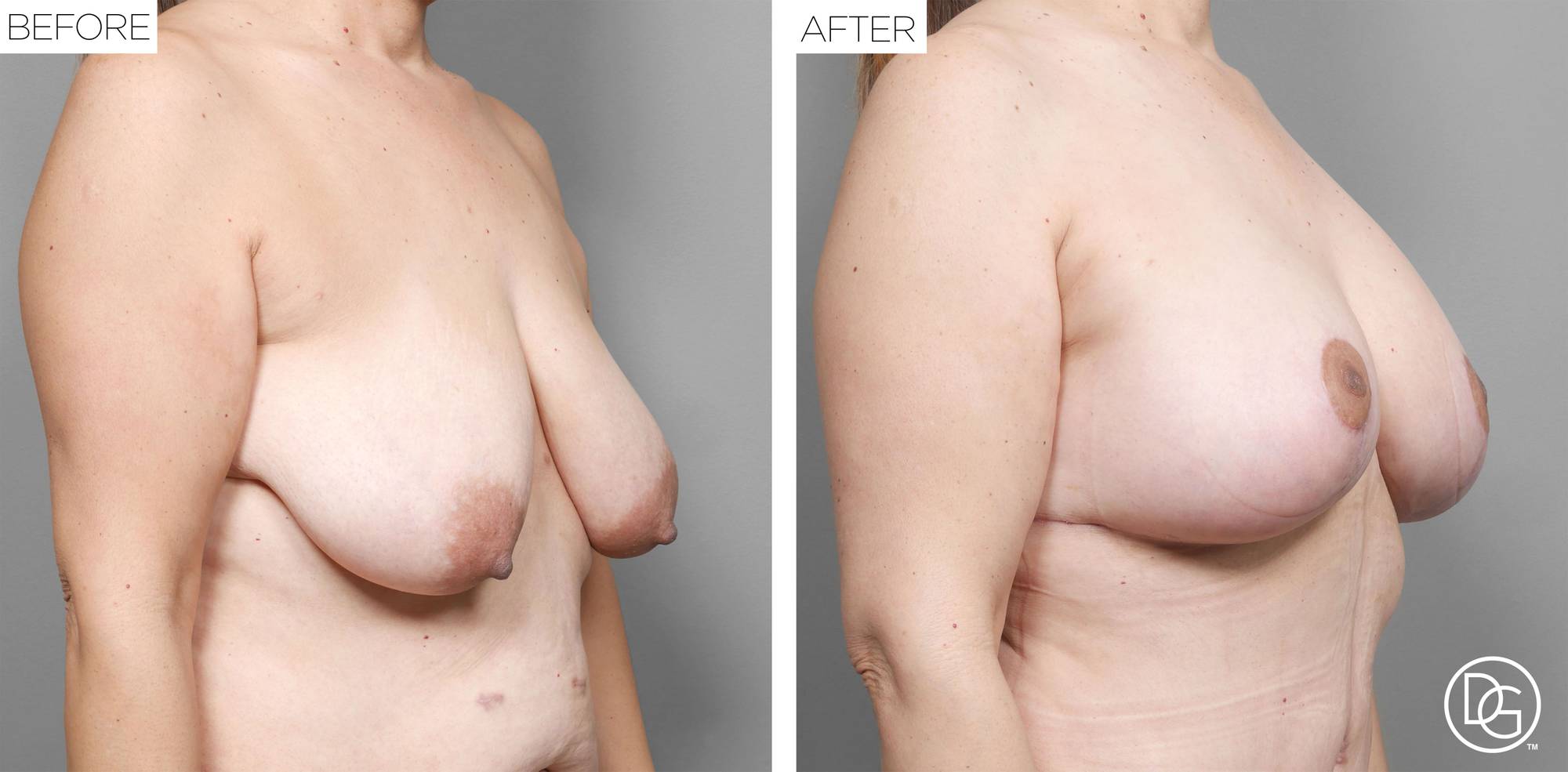 Before & After Image