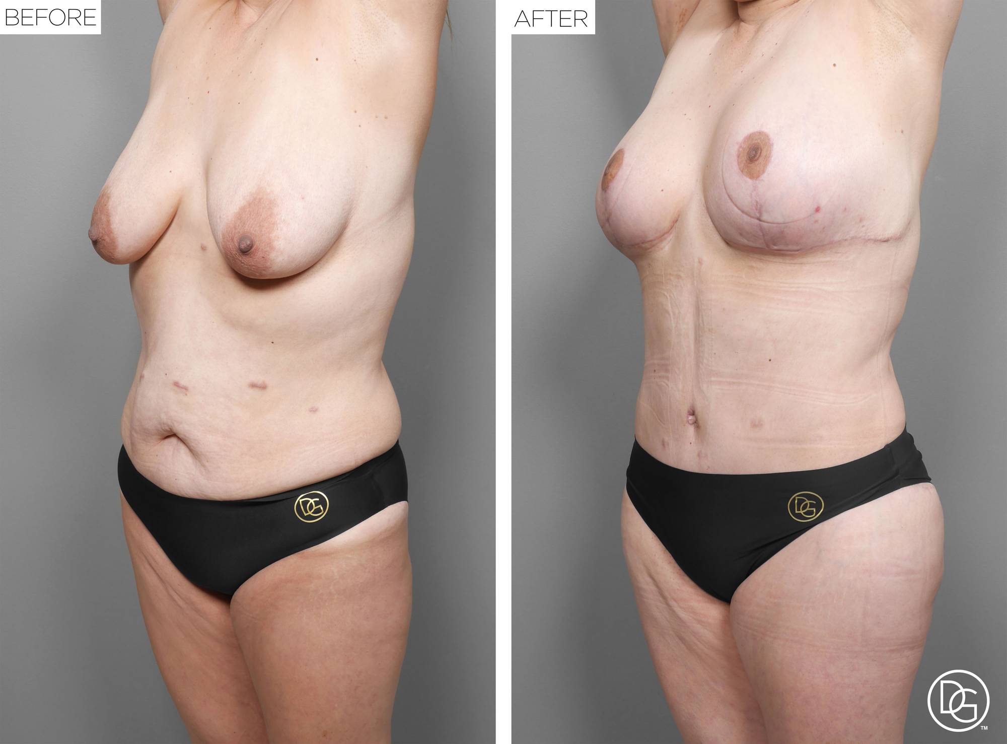 Before & After Image