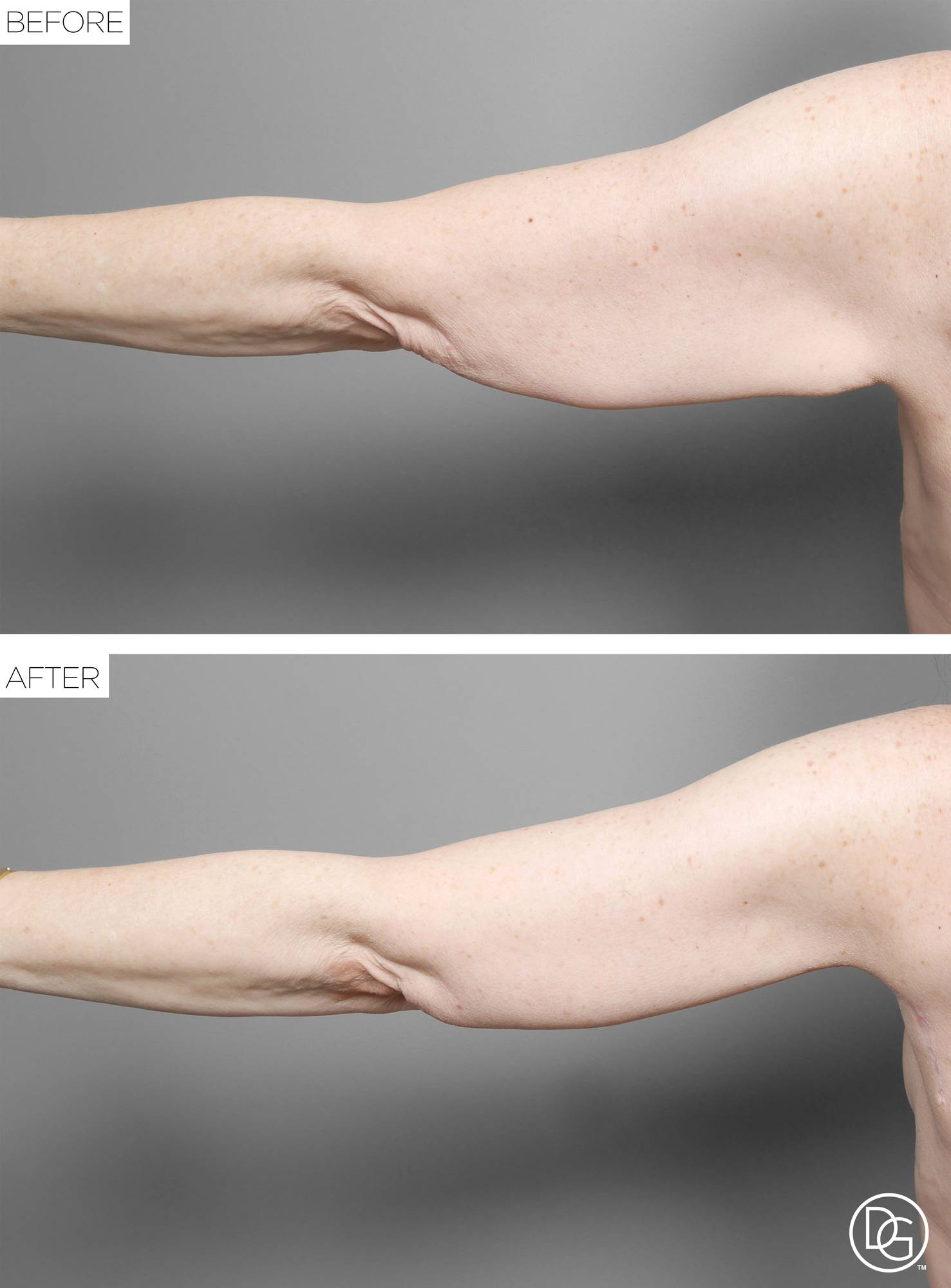 Before & After Image