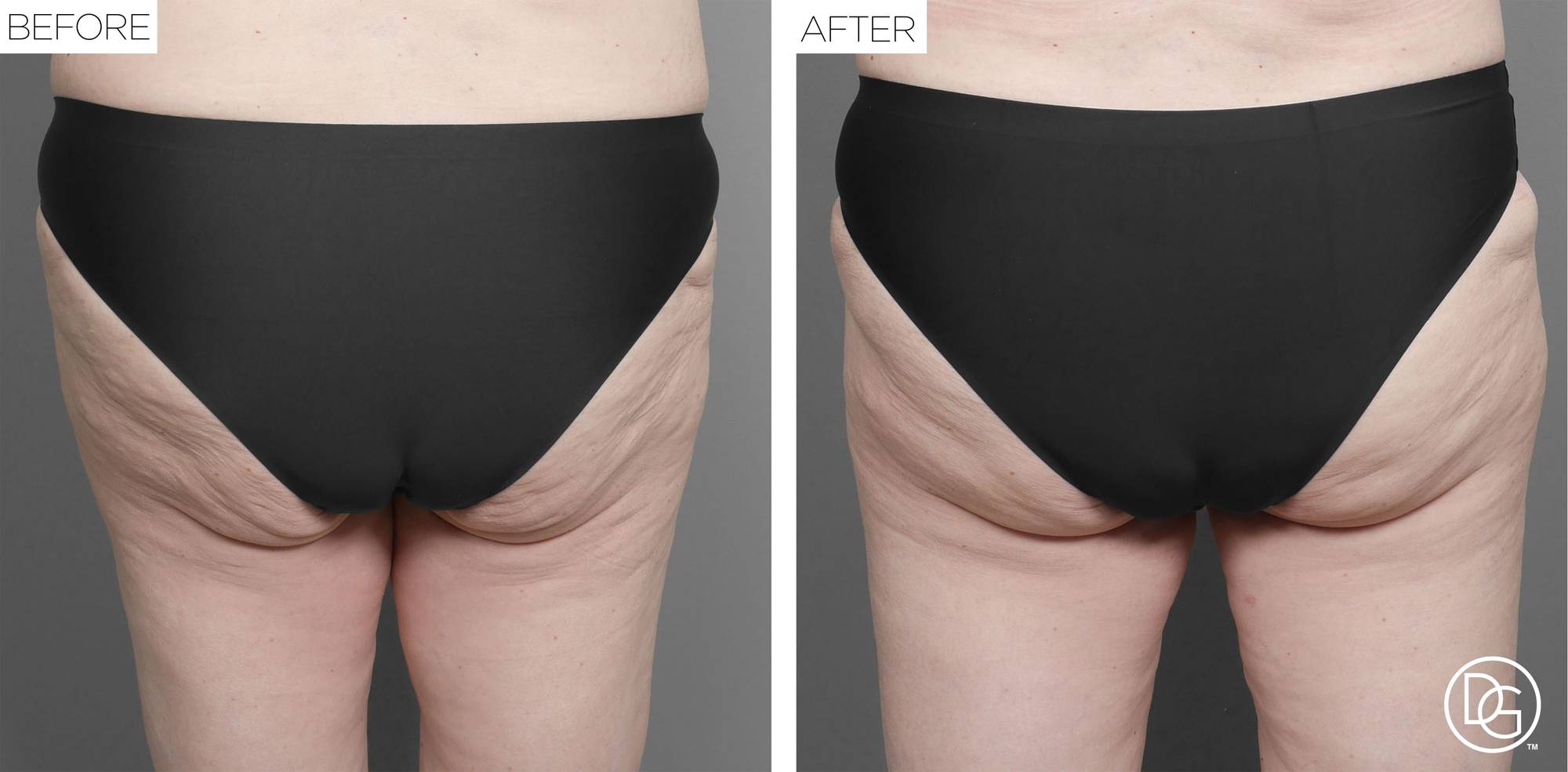 Before & After Image