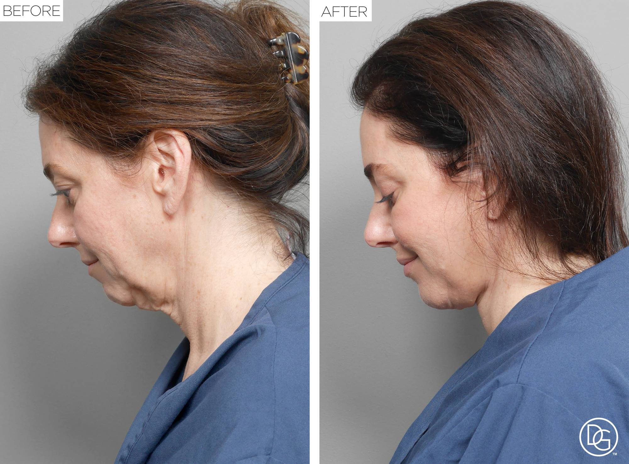 Before & After Image