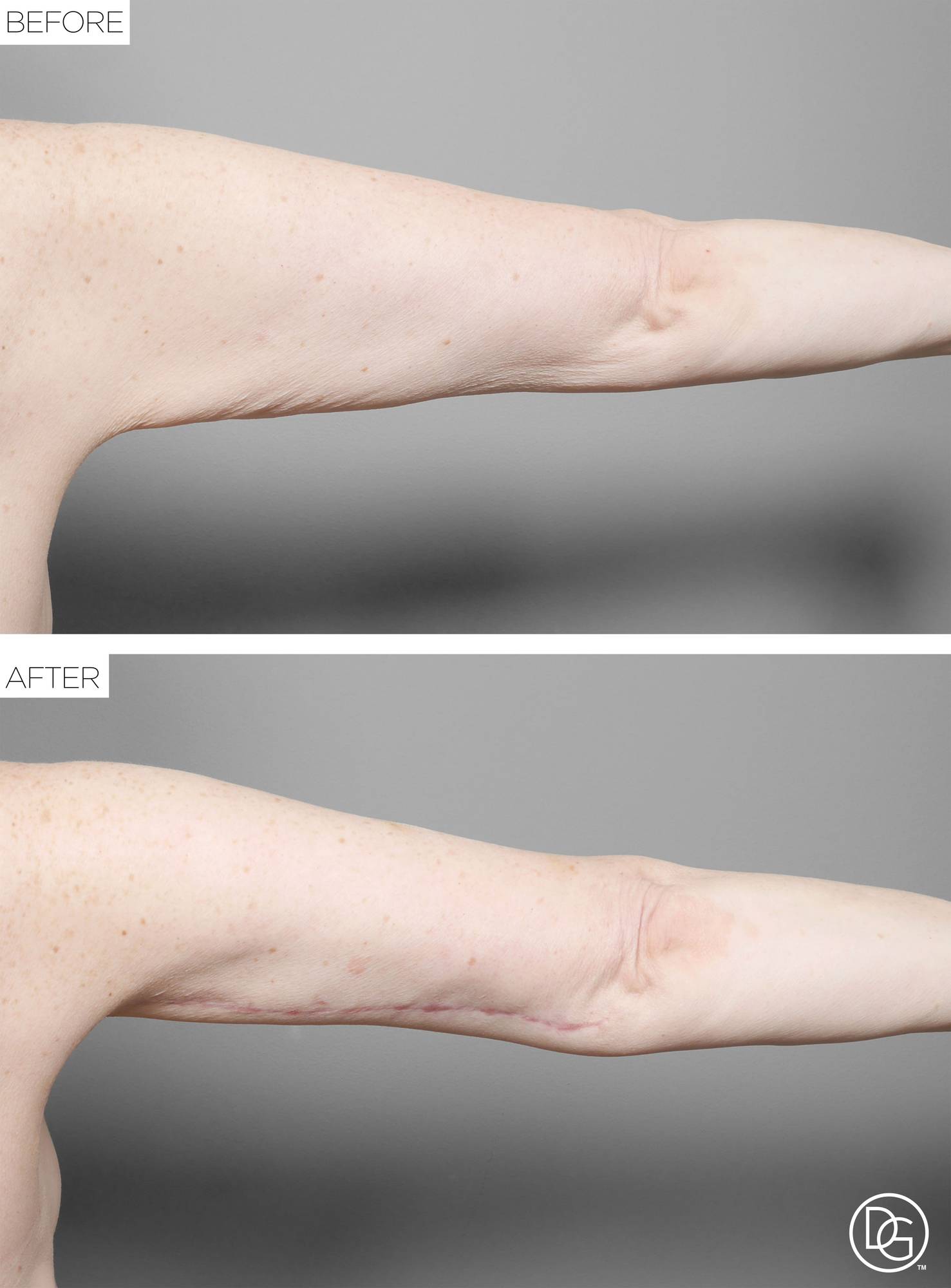 Before & After Image