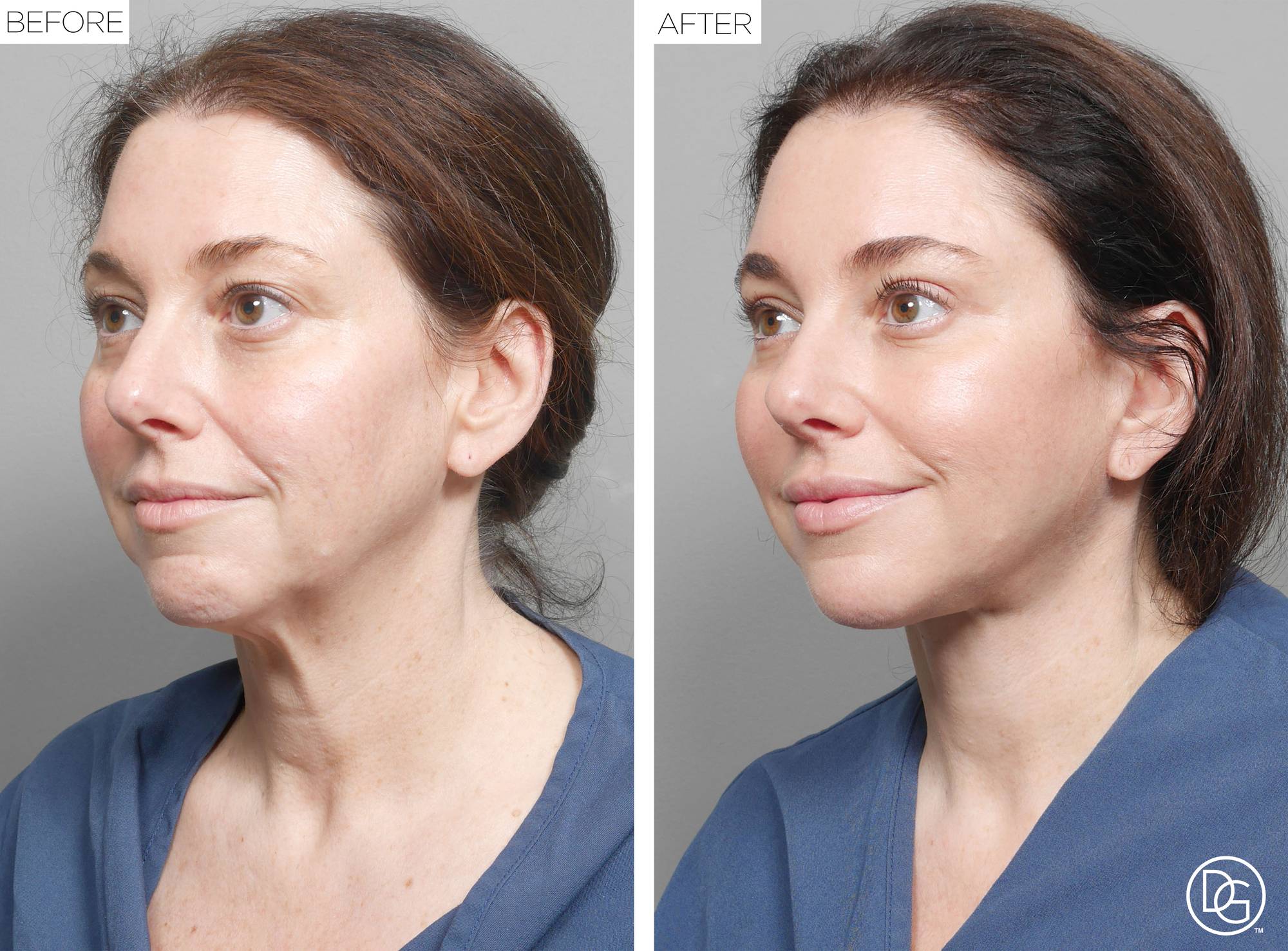 Before & After Image