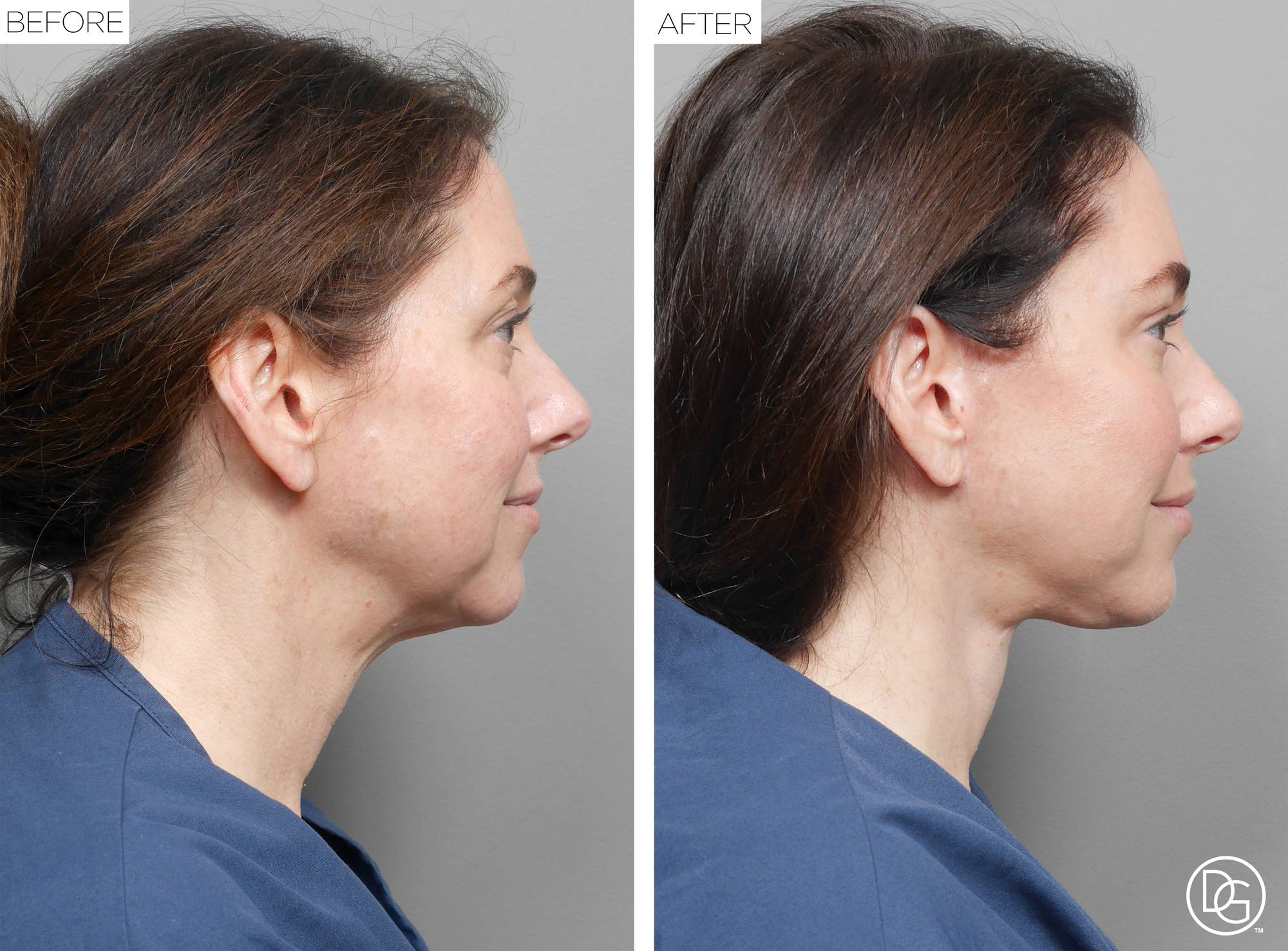 Before & After Image