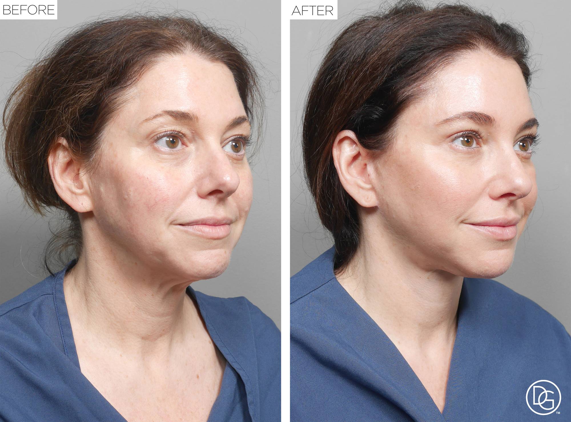 Before & After Image