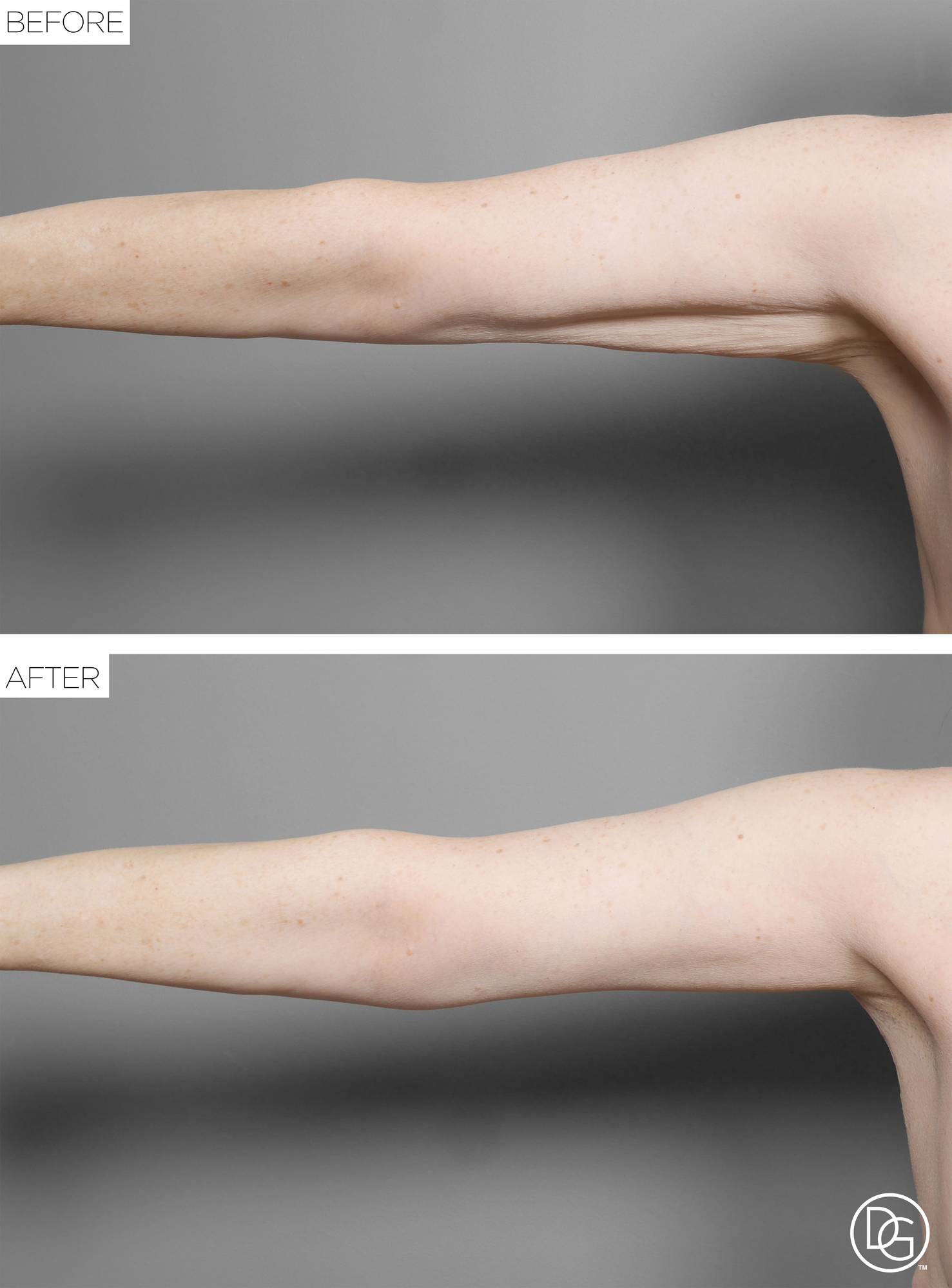 Before & After Image