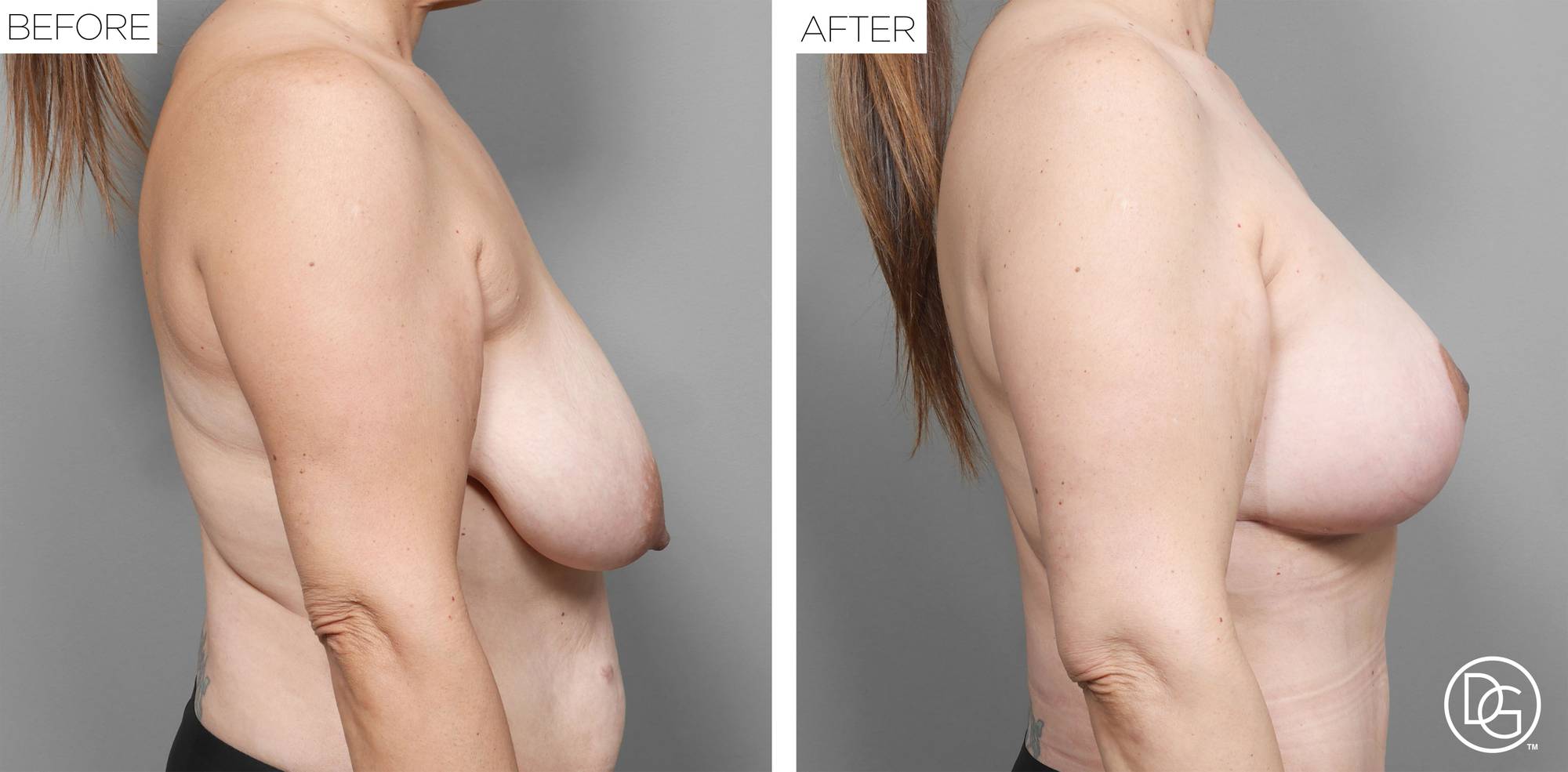 Before & After Image