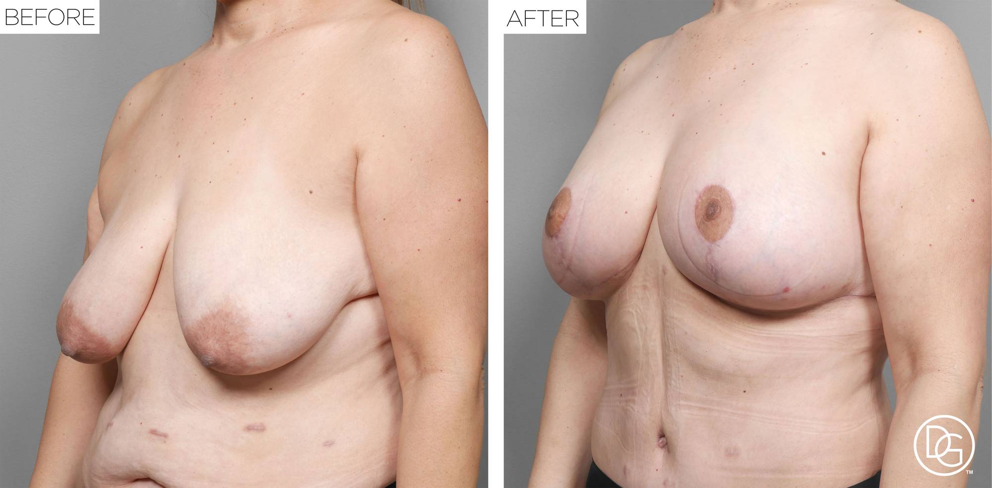 Before & After Image