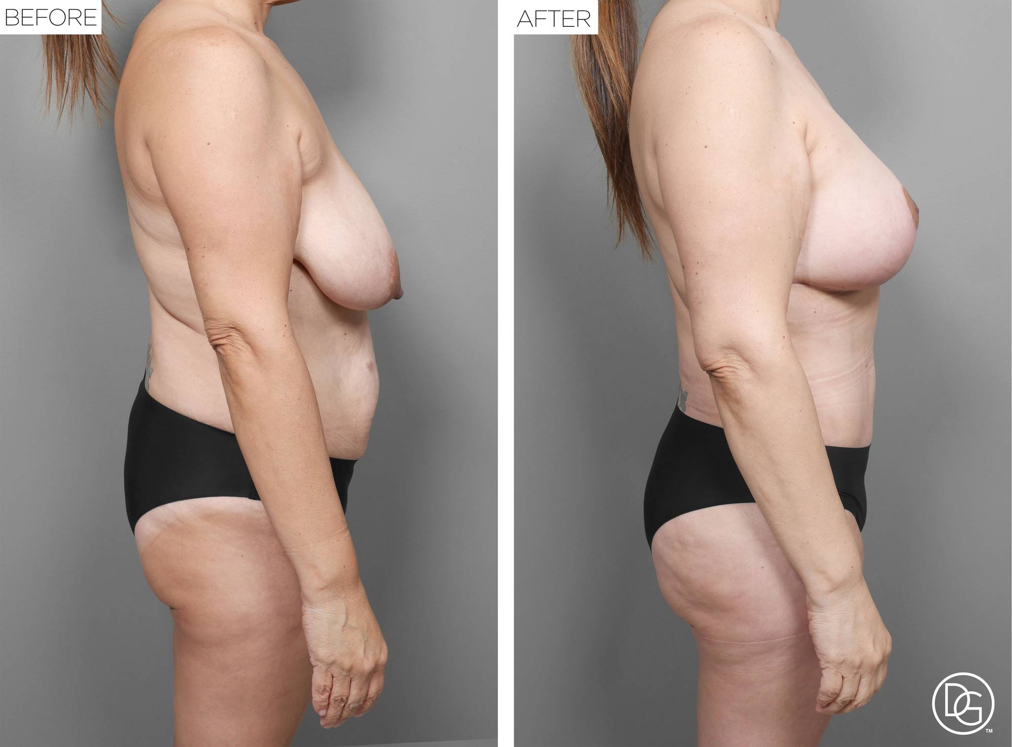 Before & After Image