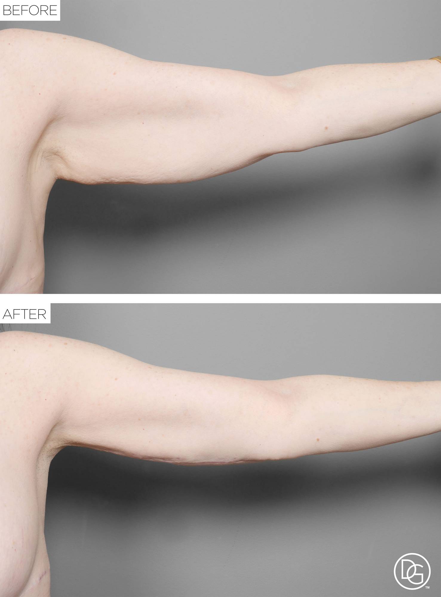 Before & After Image