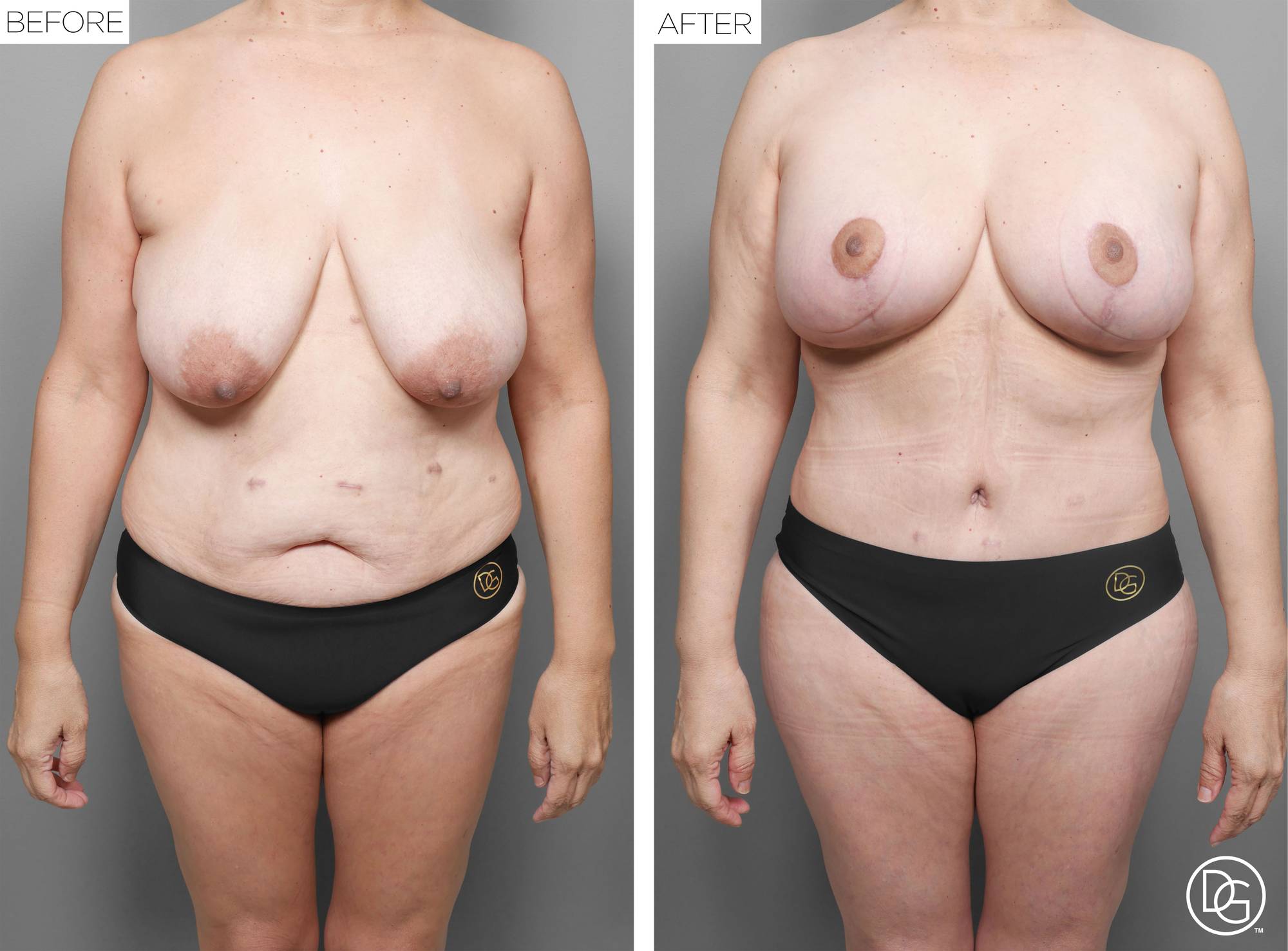 Before & After Image