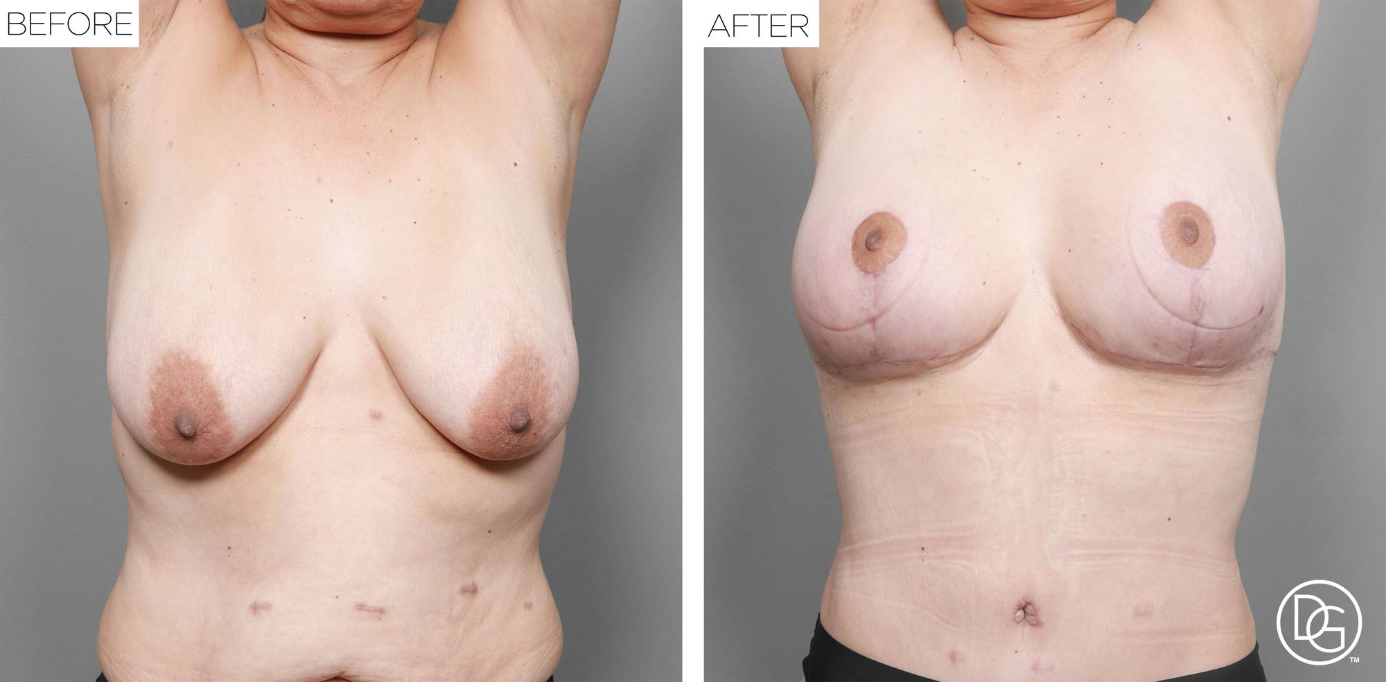 Before & After Image