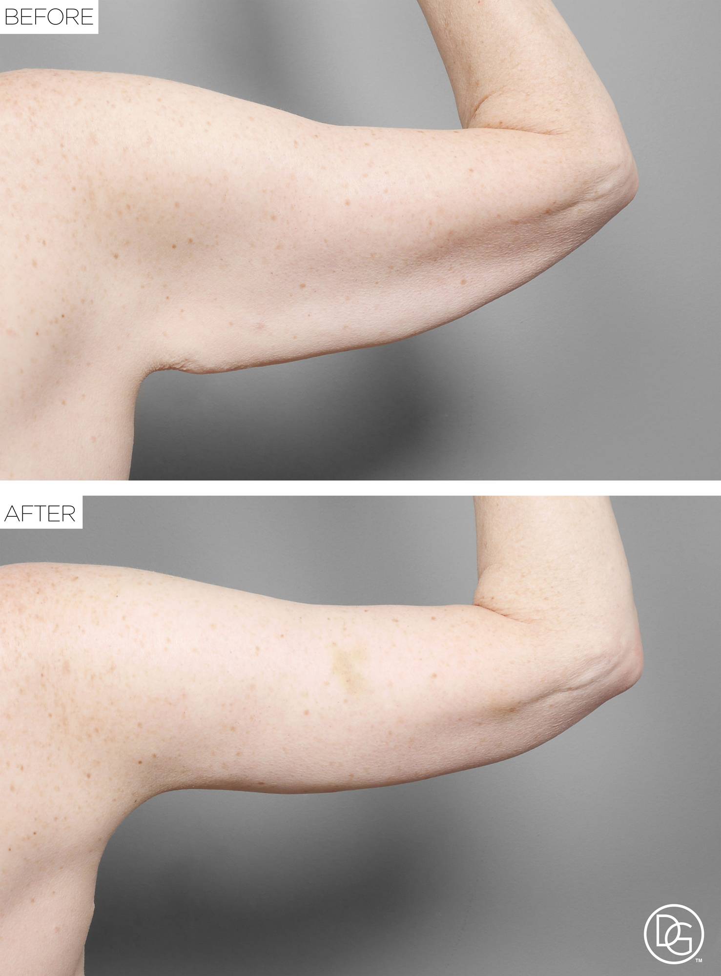 Before & After Image