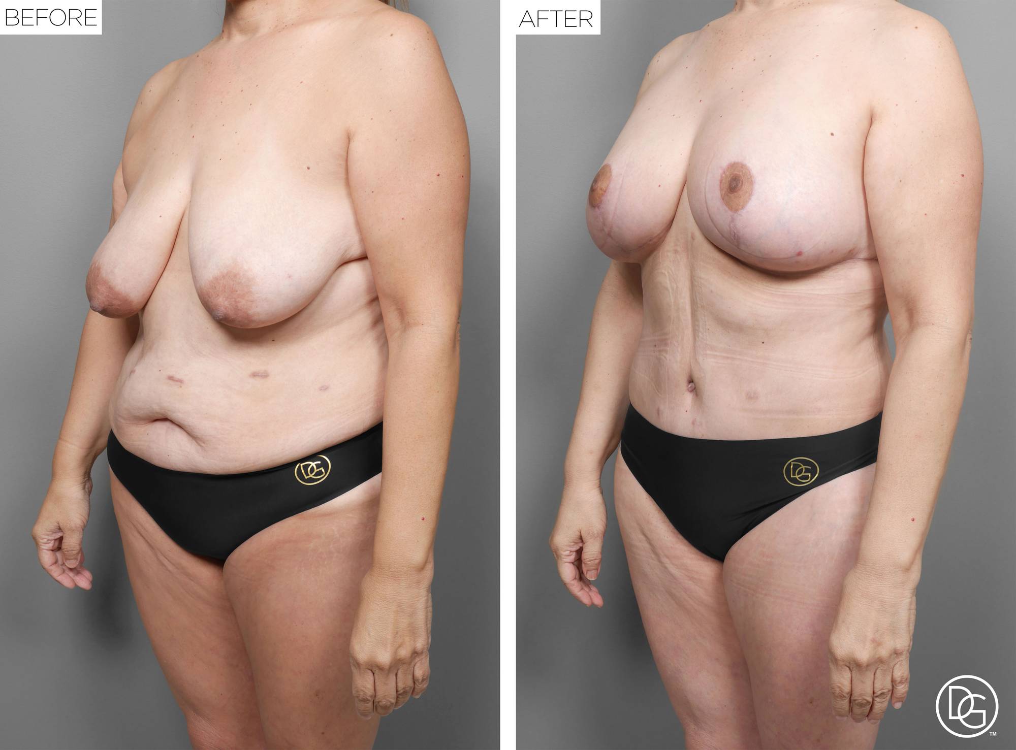 Before & After Image