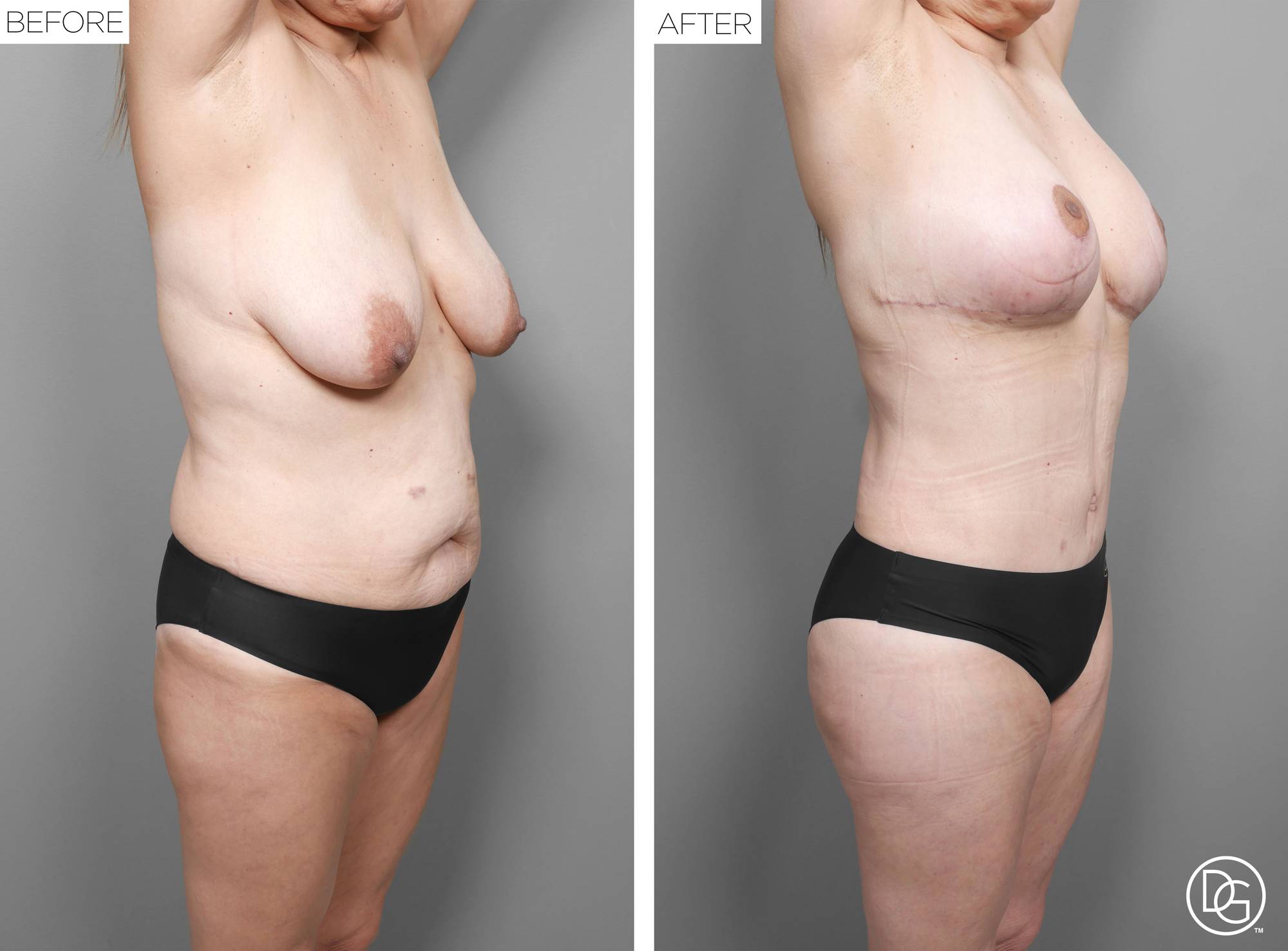 Before & After Image