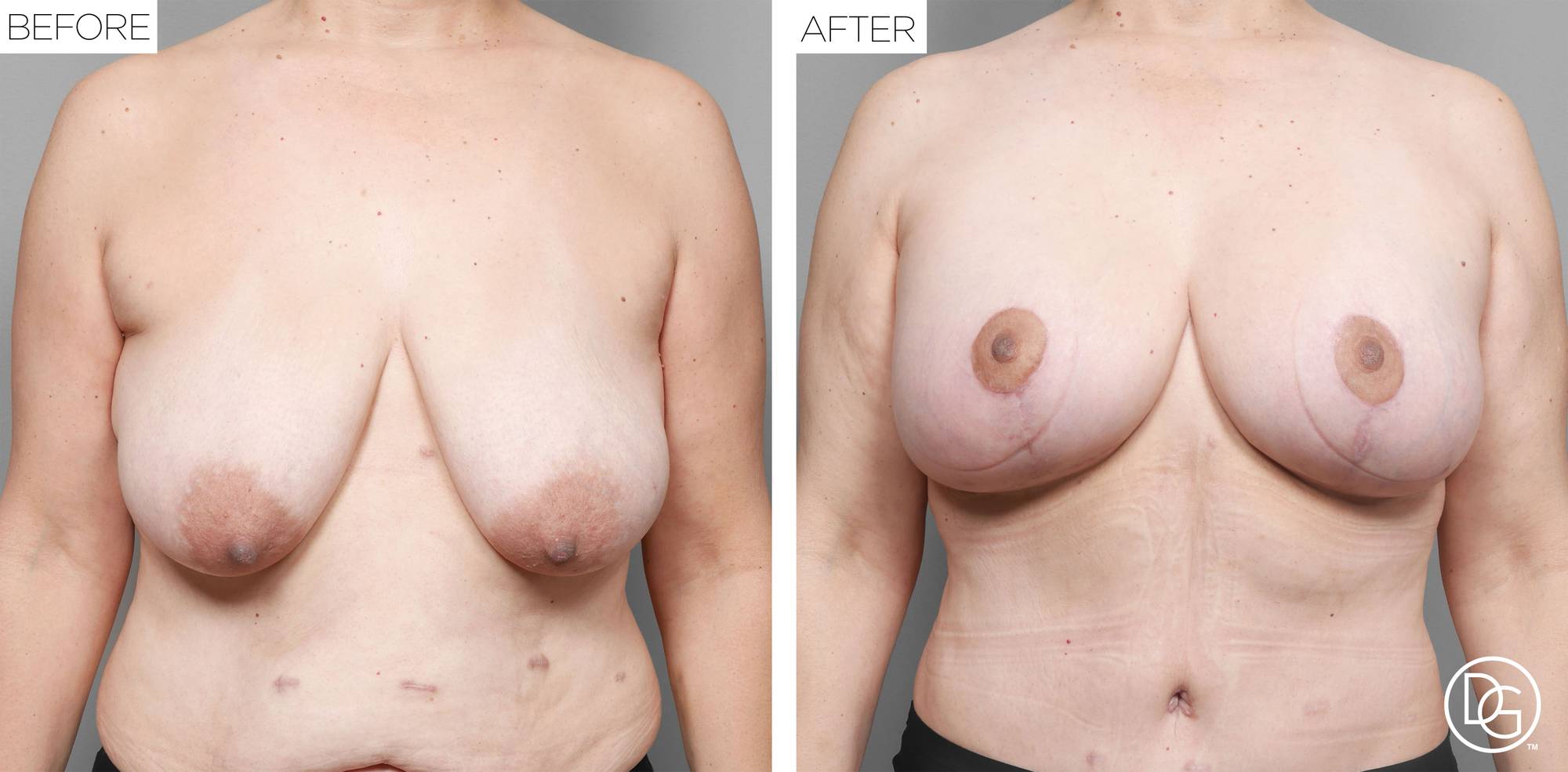 Before & After Image