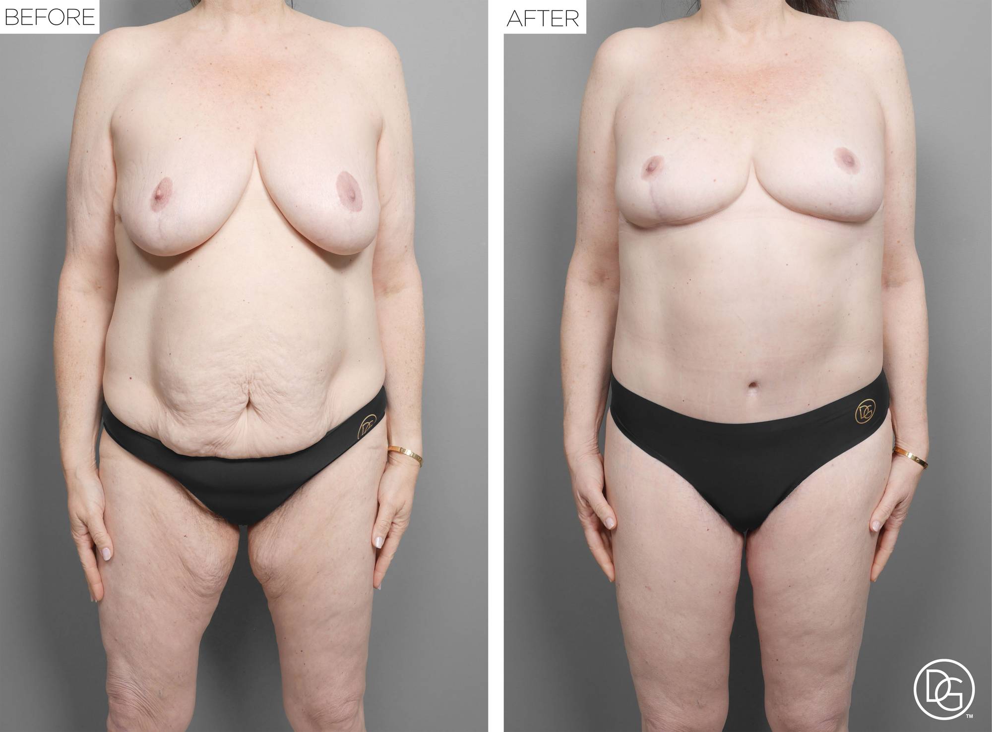 Before & After Image