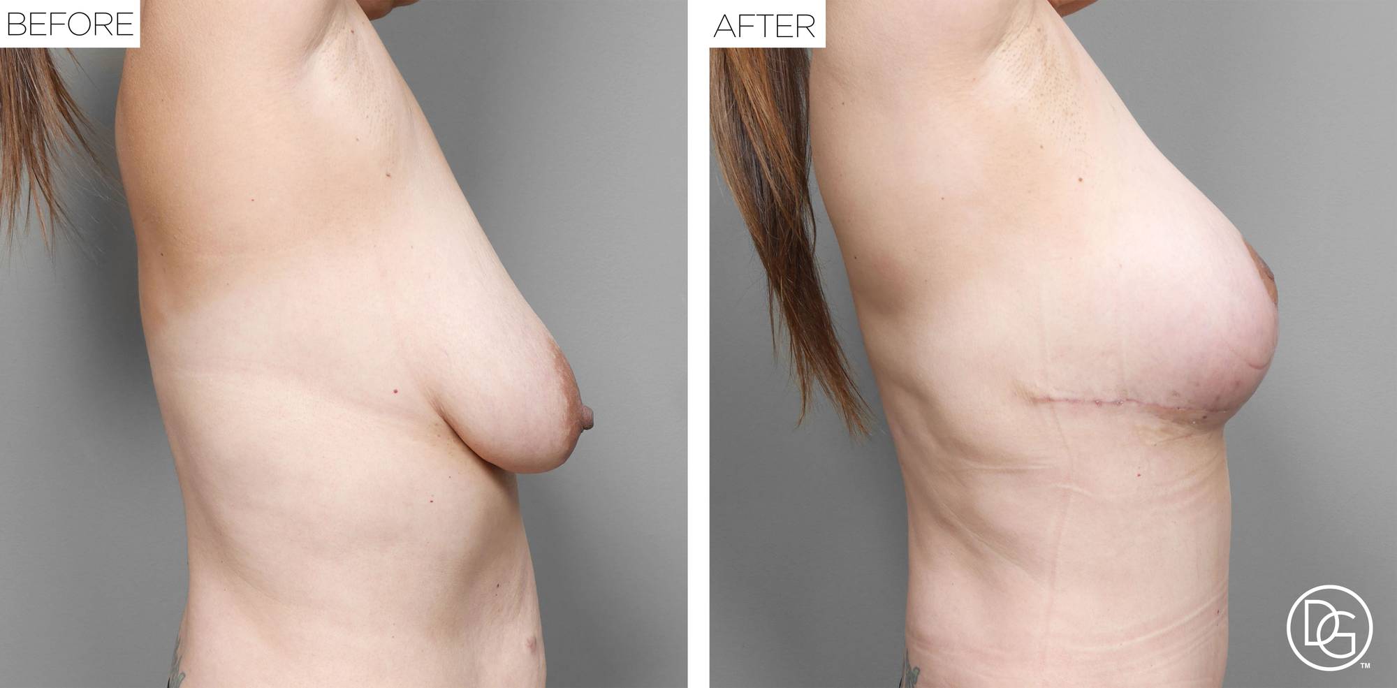 Before & After Image