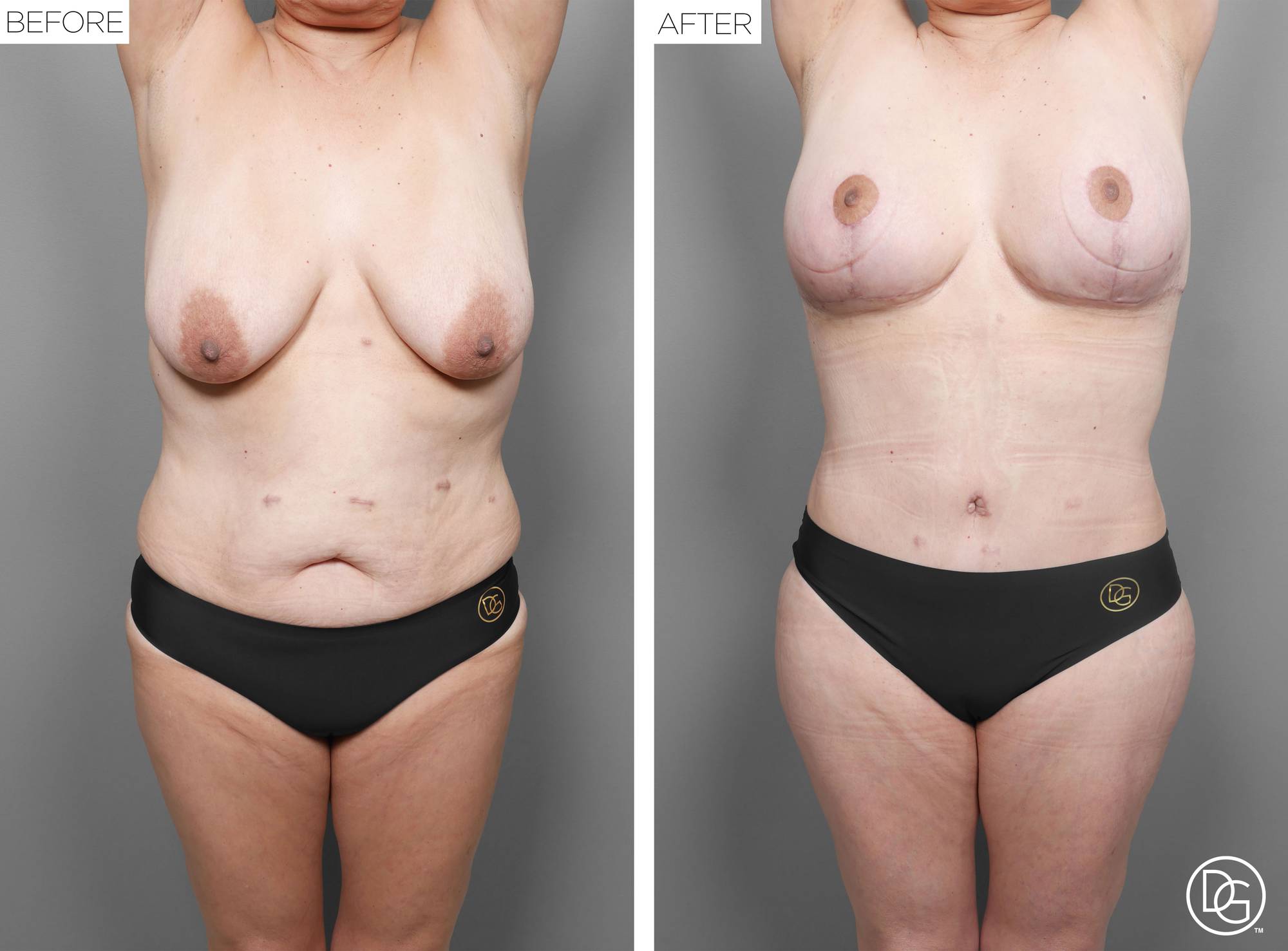 Before & After Image