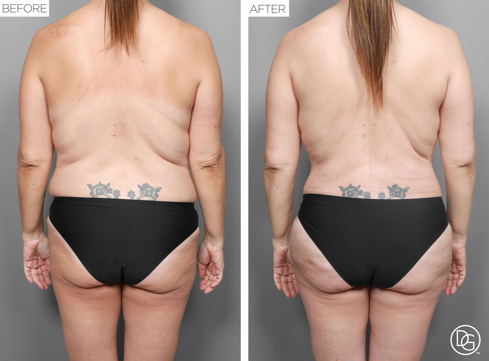 Before & After Image