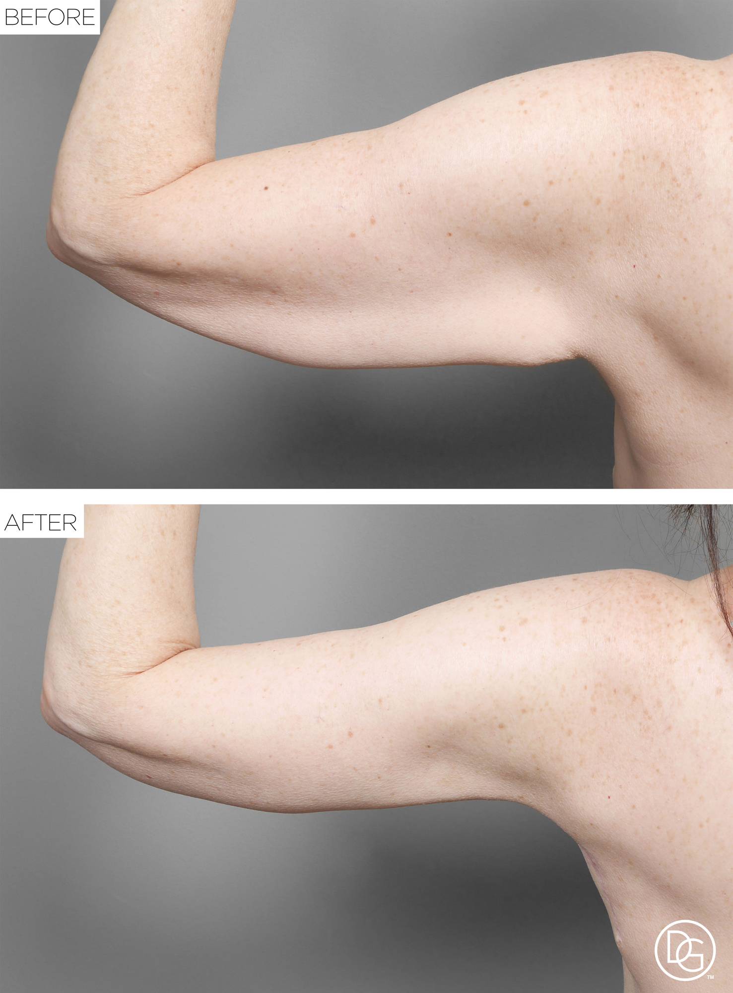 Before & After Image