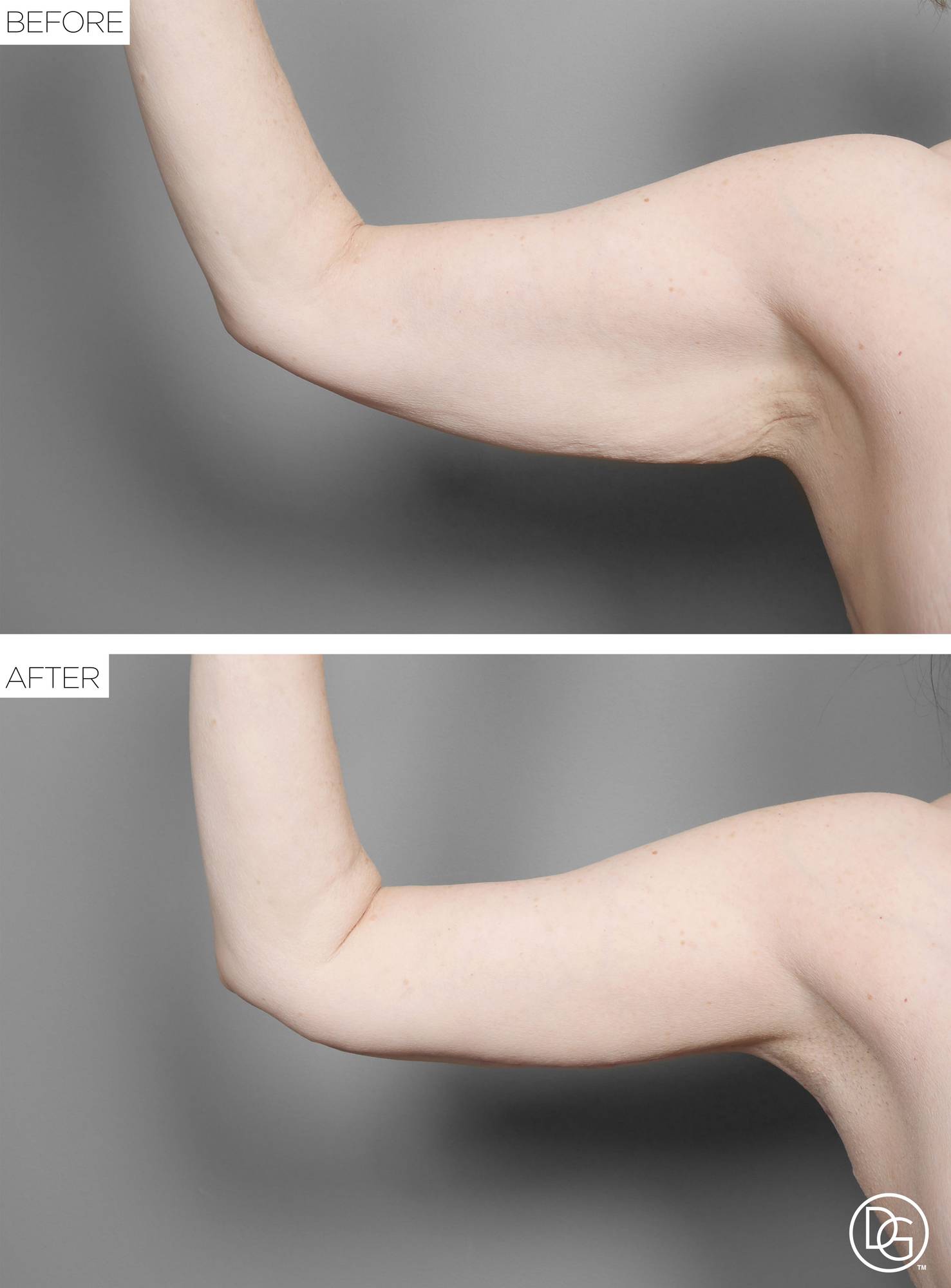 Before & After Image