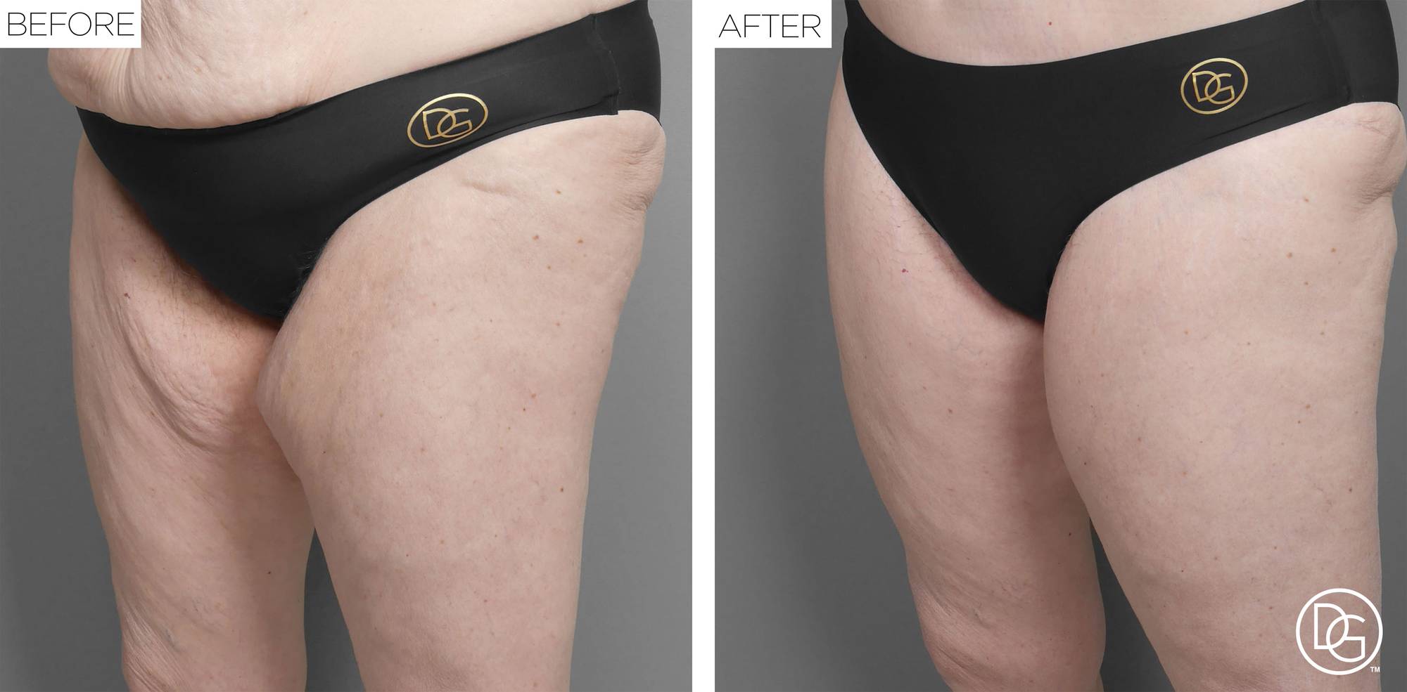 Before & After Image