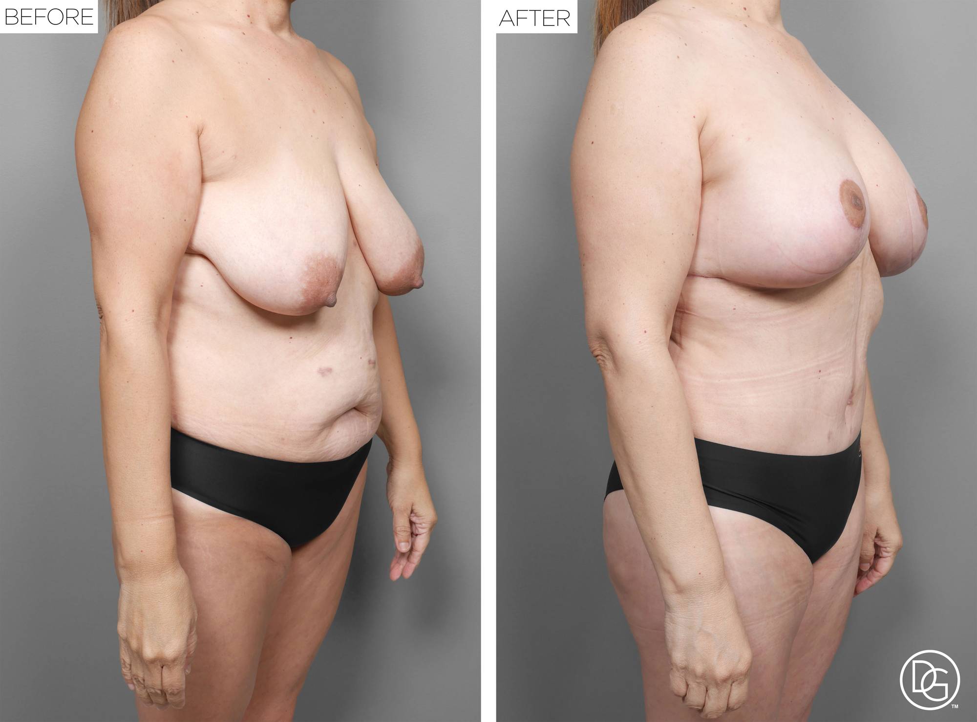 Before & After Image